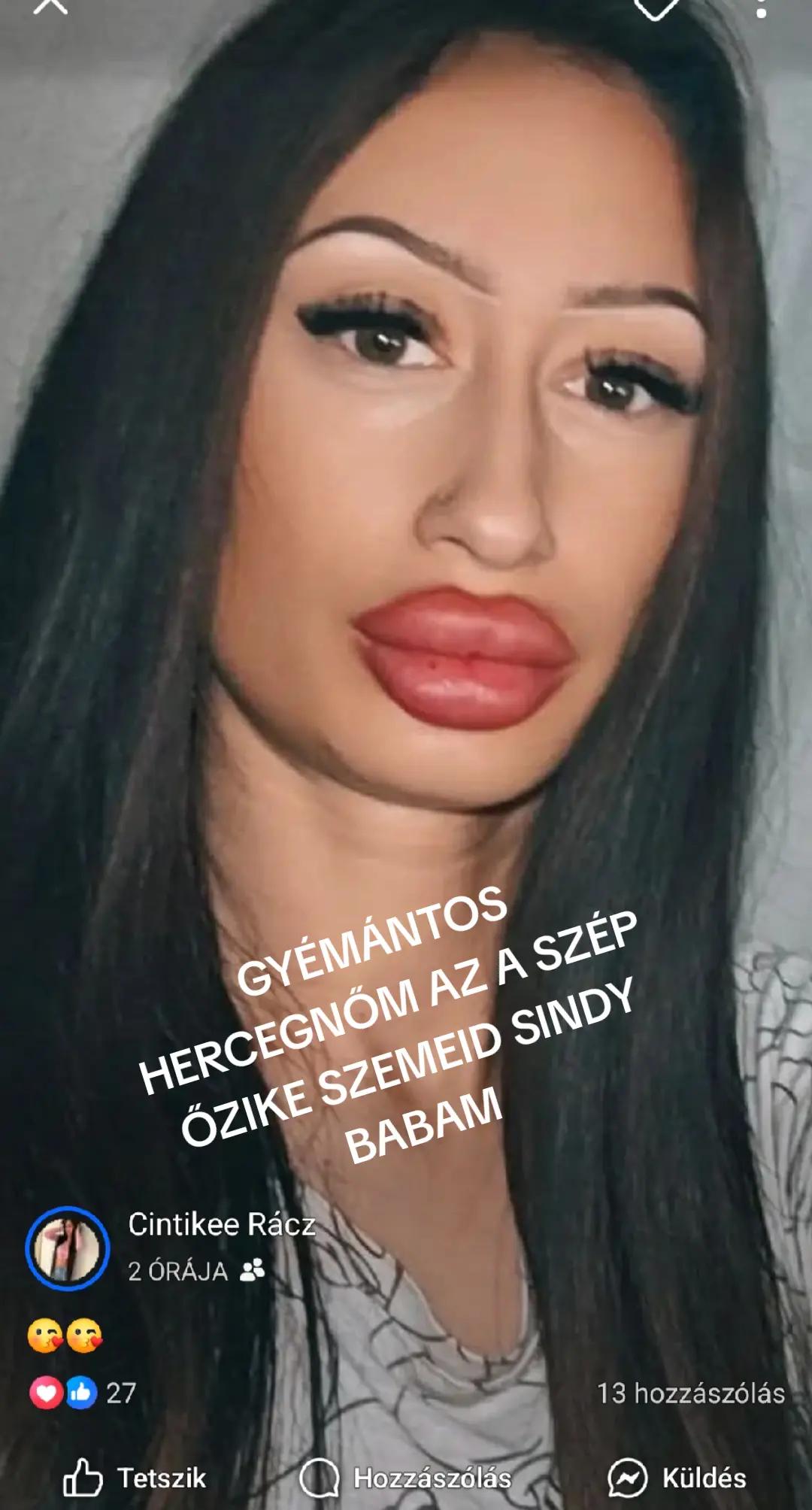 @Cilioszi