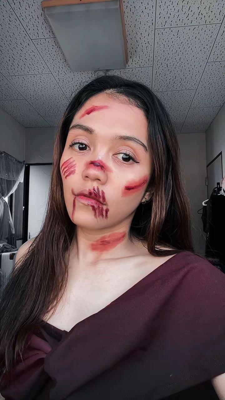 @Devimustikaaa_ || Kesmas🩺