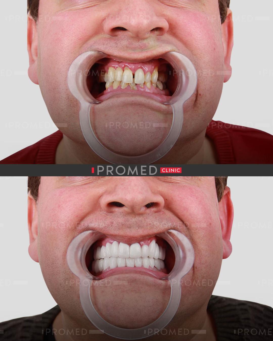 @promeddentalclinic