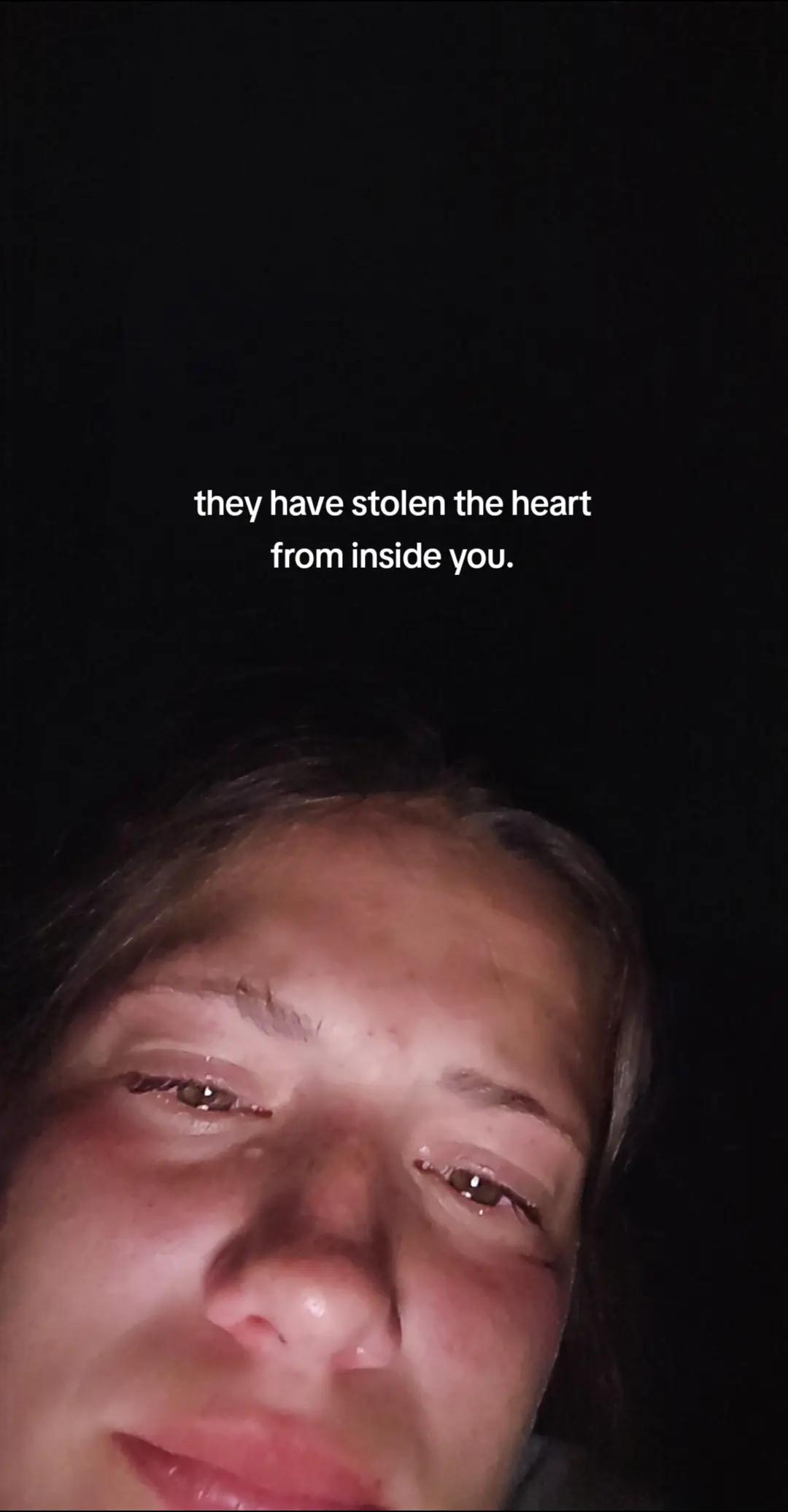 @adalynn.