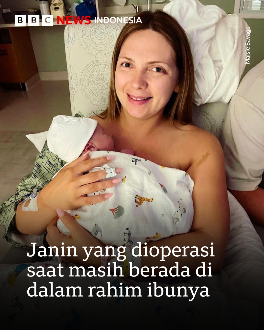 @bbcnewsindonesia