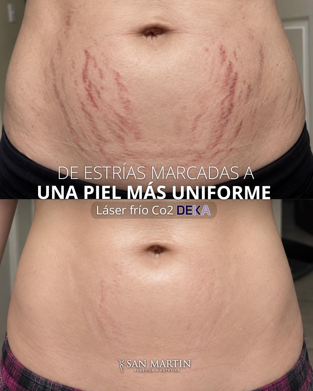 @Clínica San Martín