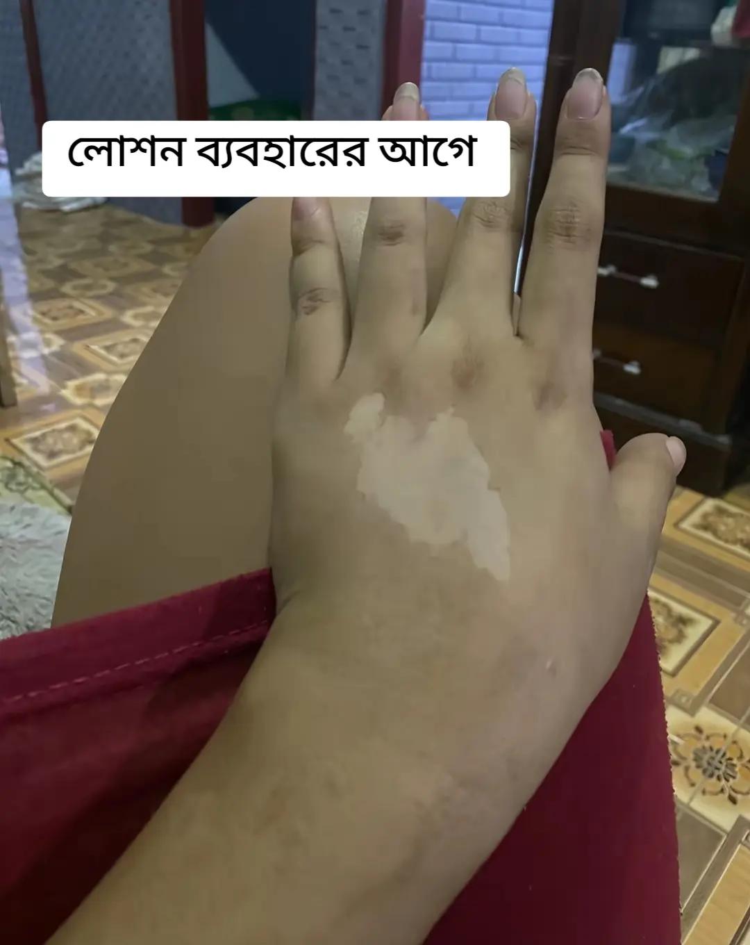 @Shebis skin care