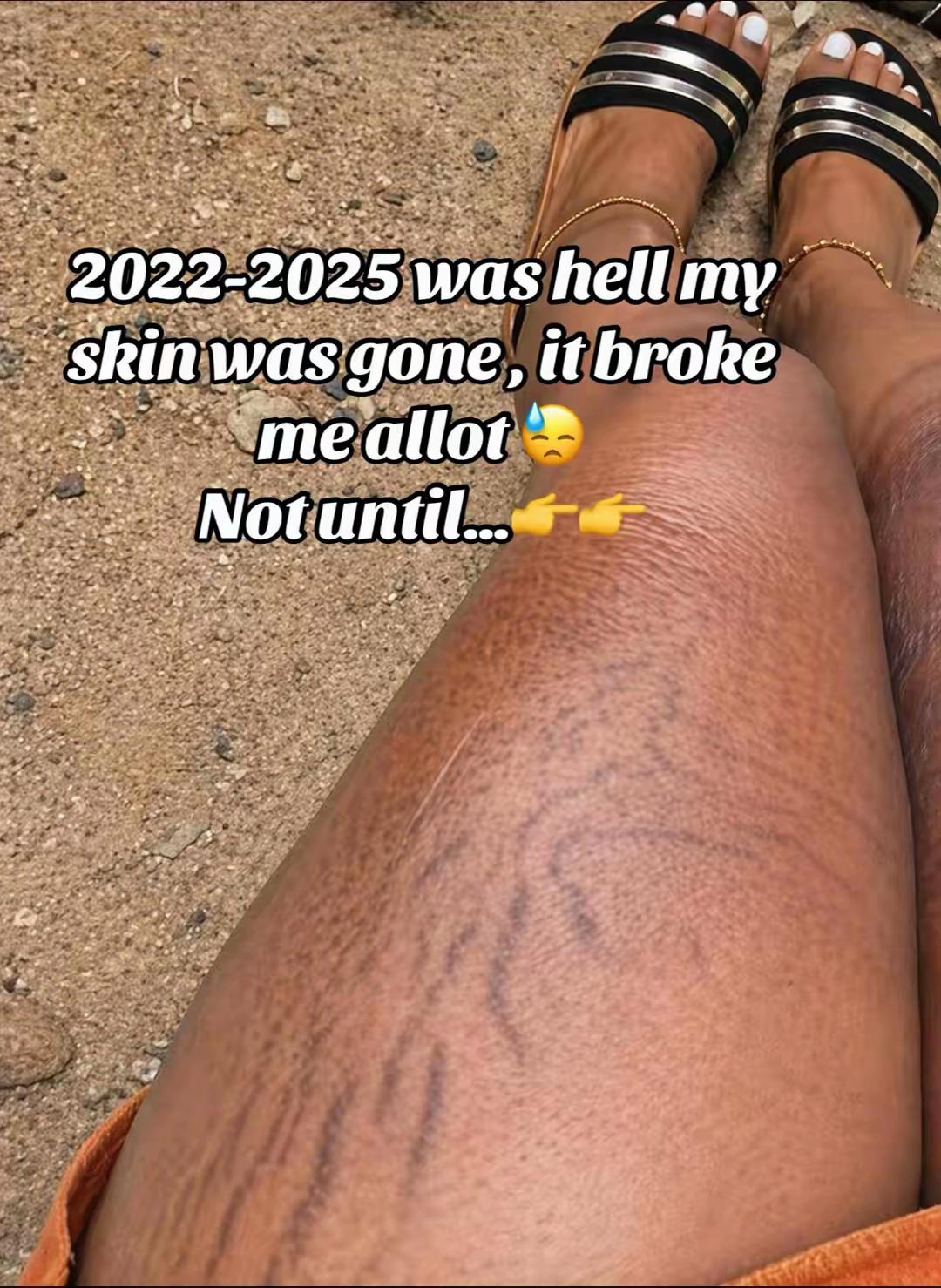 @Radiant skin