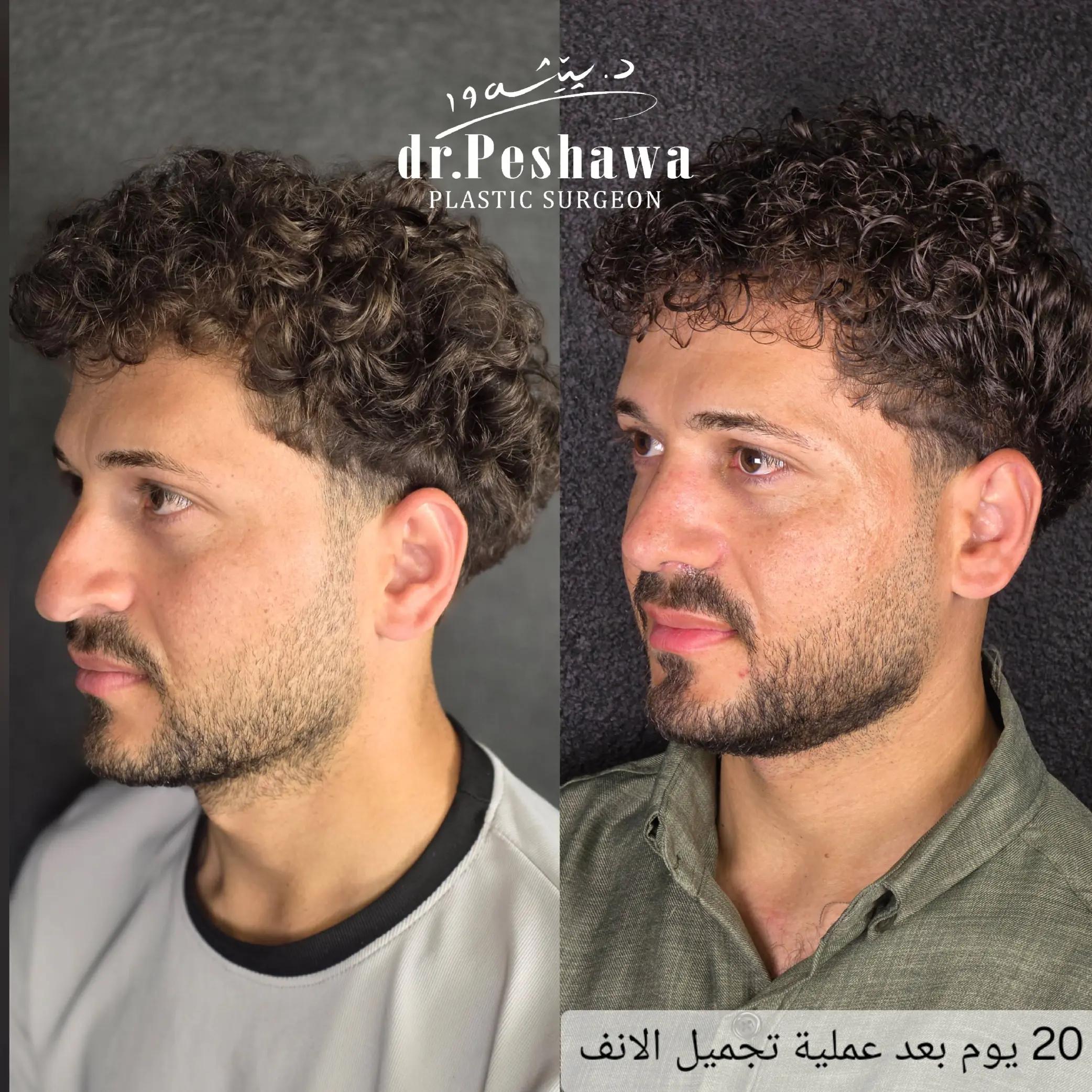 @Dr. Peshawa Plastic Surgeon