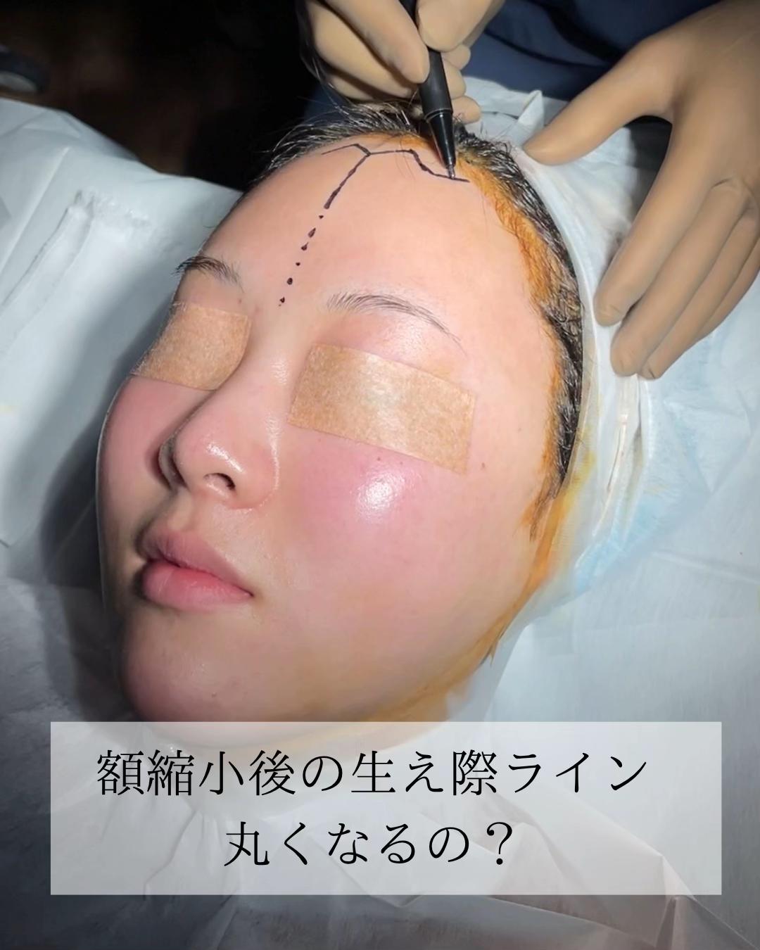 @鼻整形R Beauty CLINIC 副院長👨&zwj;⚕️吉田慧
