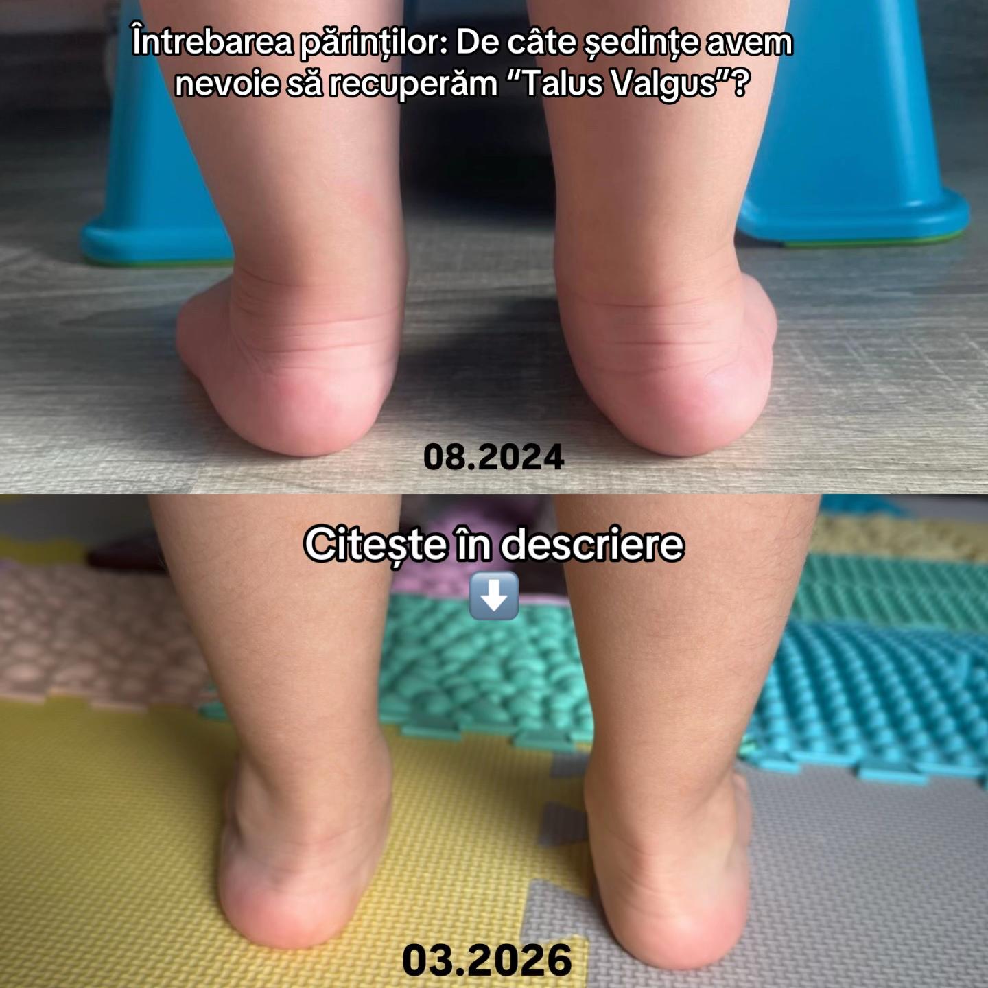 @Kinetoterapeut Maria Irașcu