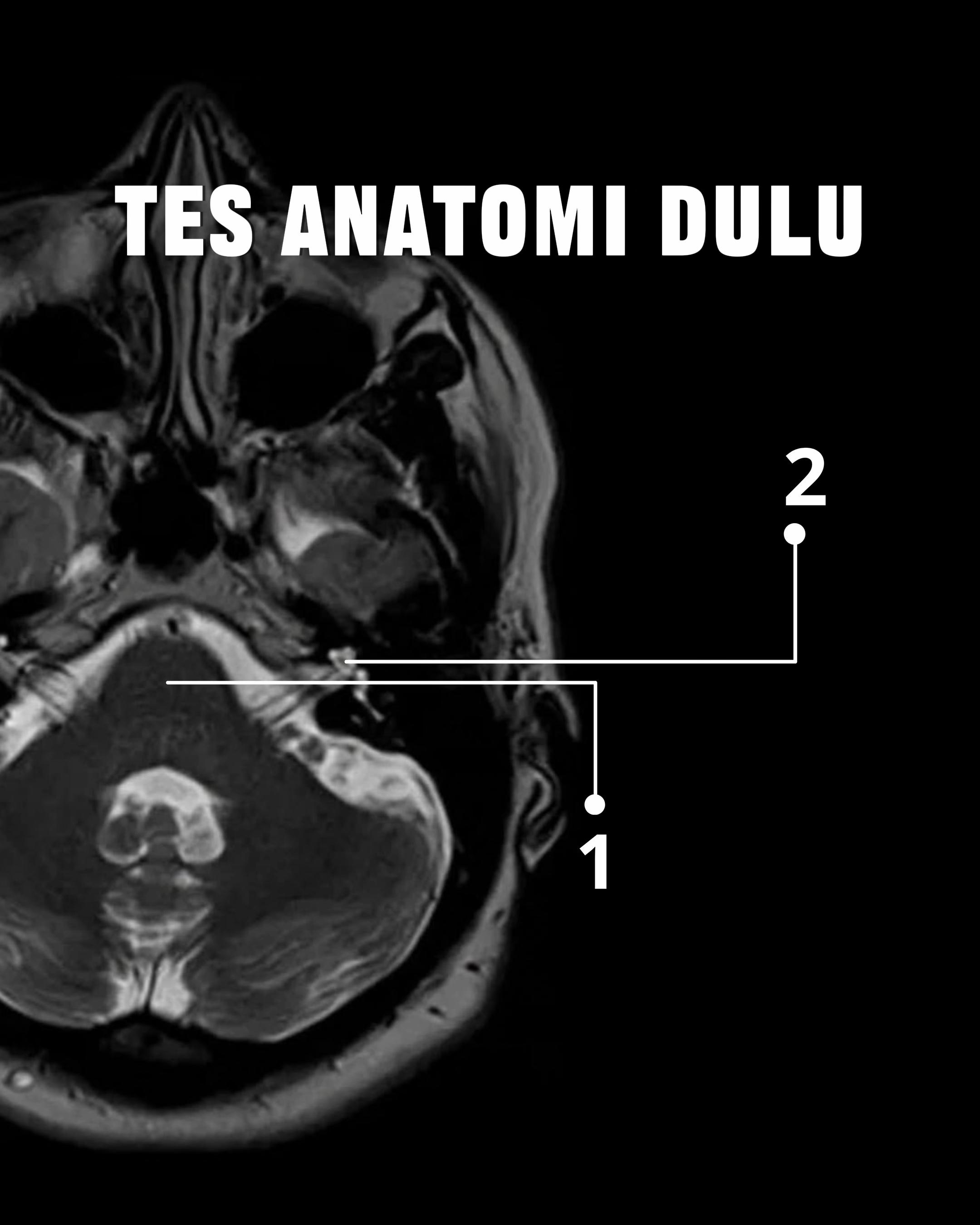 @Sobat Radiology