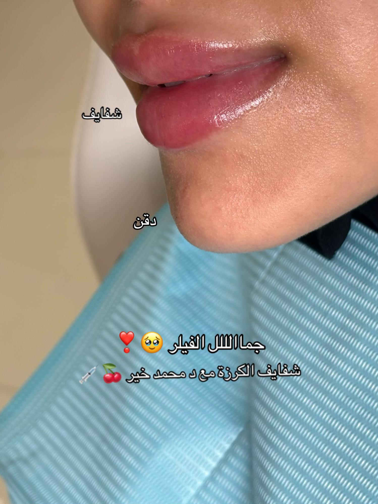 @Dr. Mohamed khier