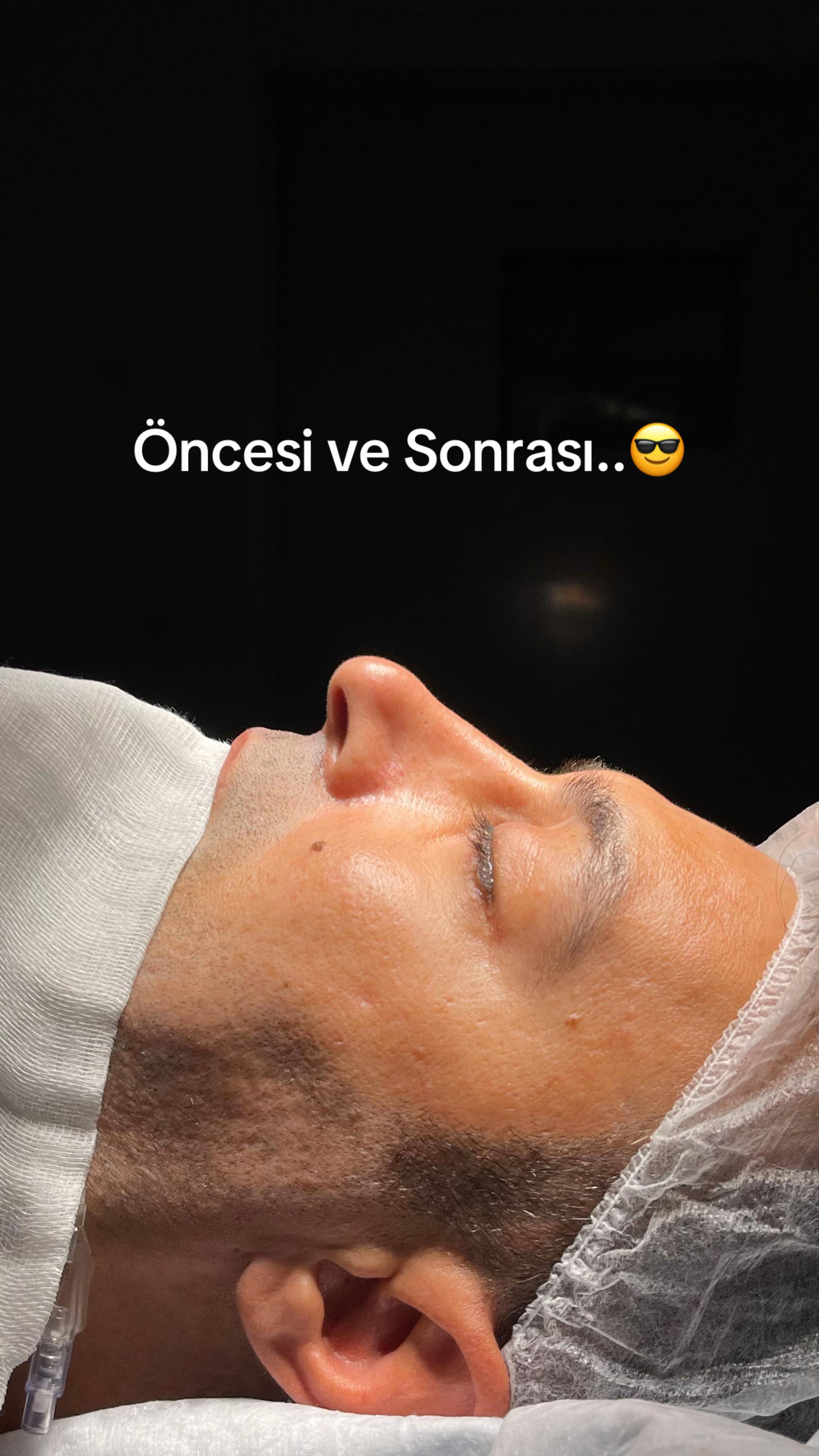 @SonStyLa Official