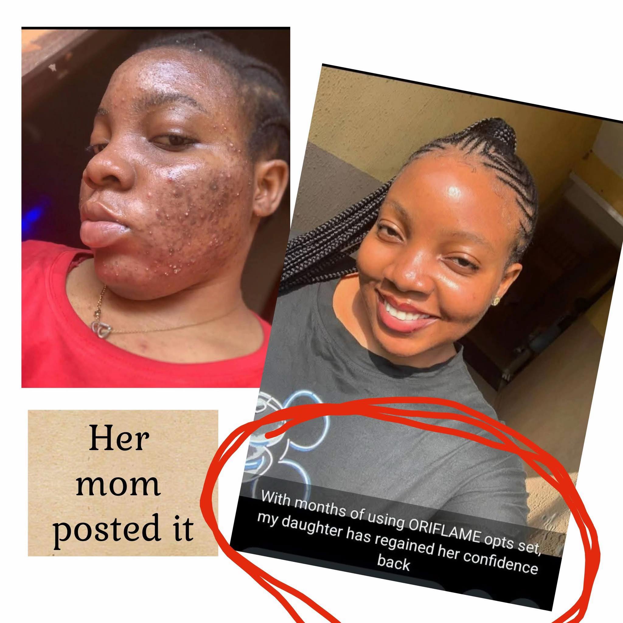 @🧴Marvell Skincare Benin city