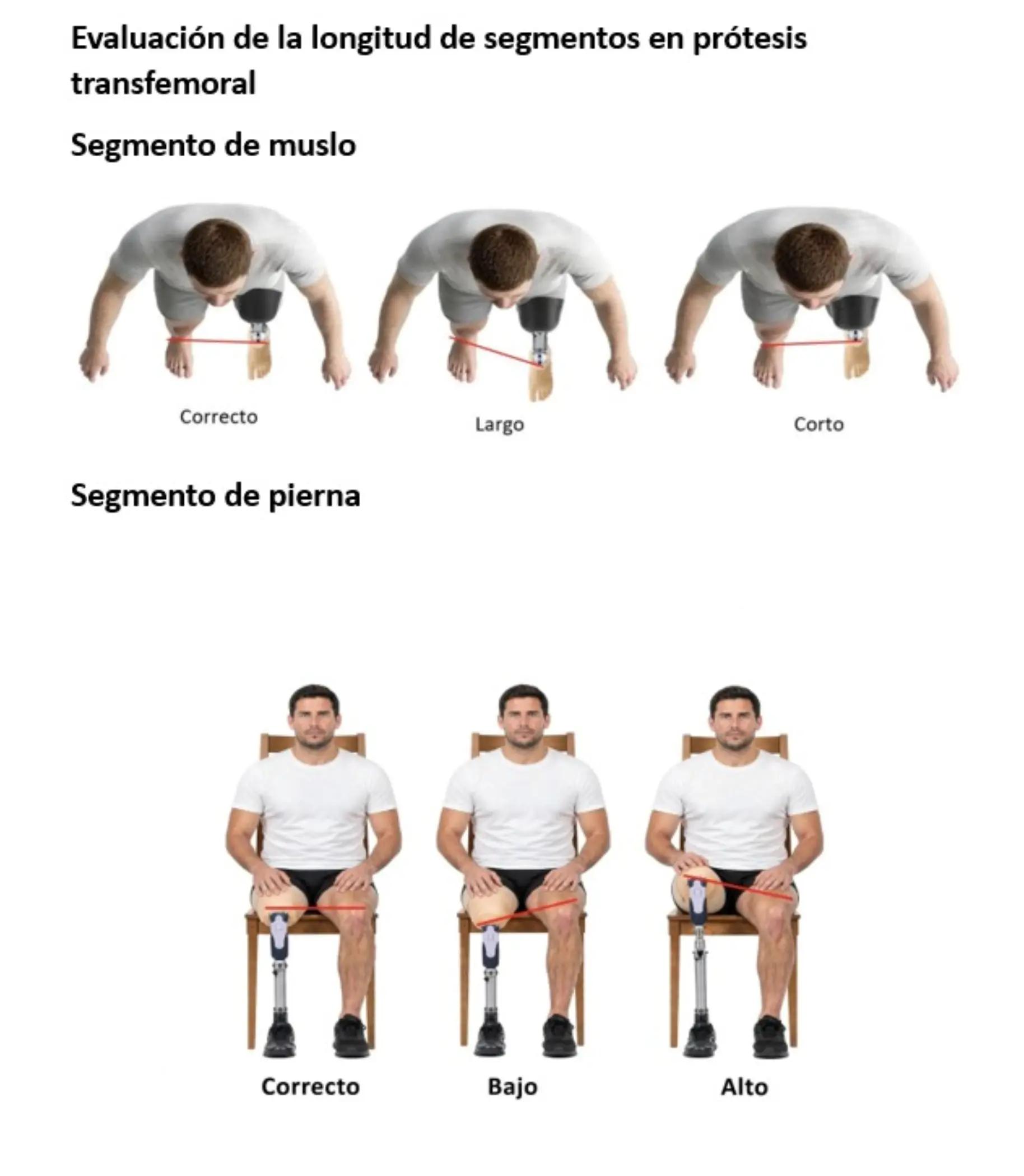 @Customized Prótesis