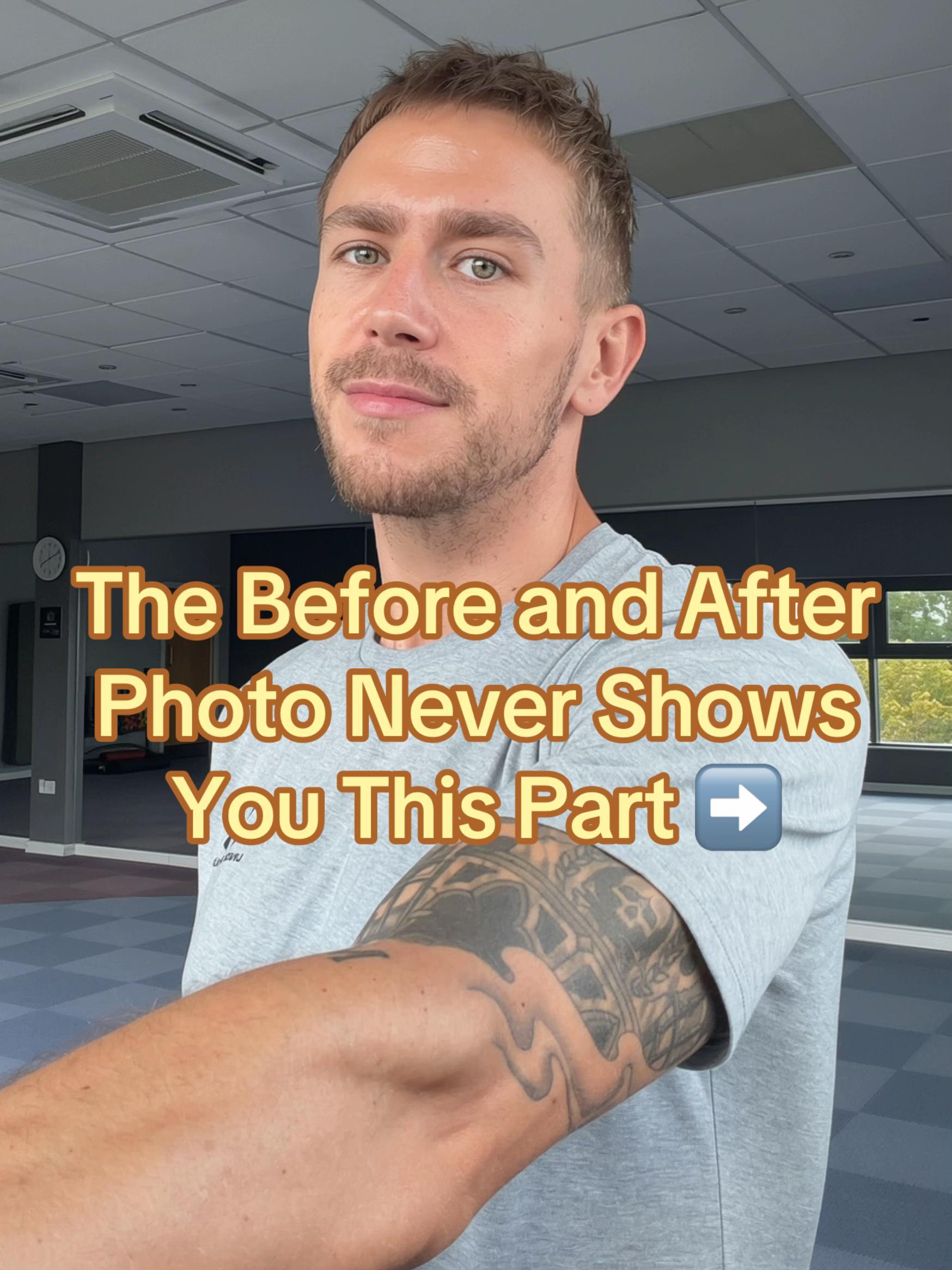 @KD | Life After Weight Loss
