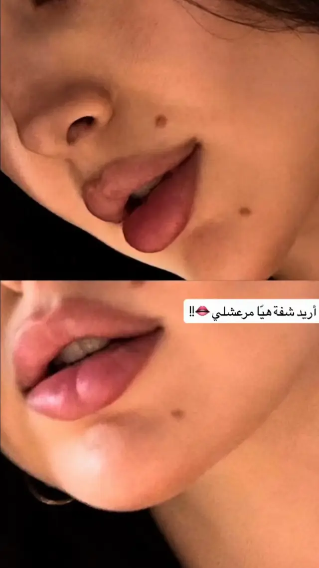@Dr. Mohamed khier