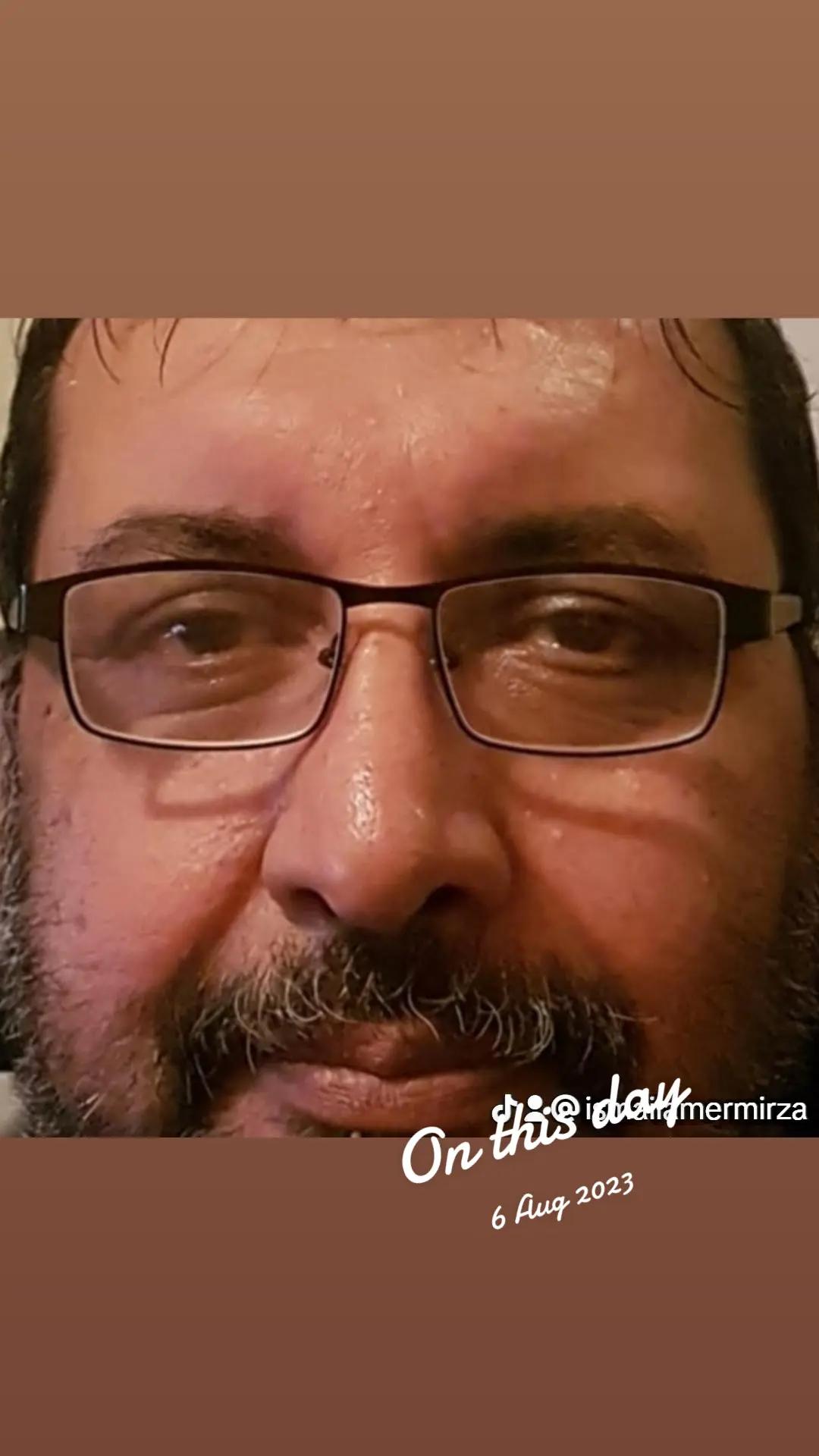 @Ismail Mirza