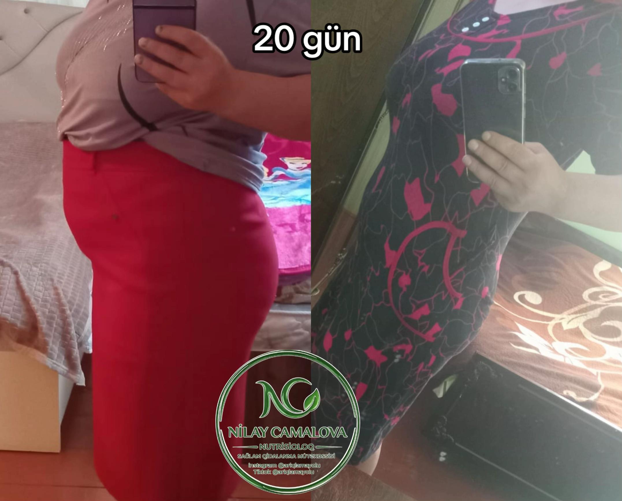 @Nutrisioloq Nilay Camalova 🥑