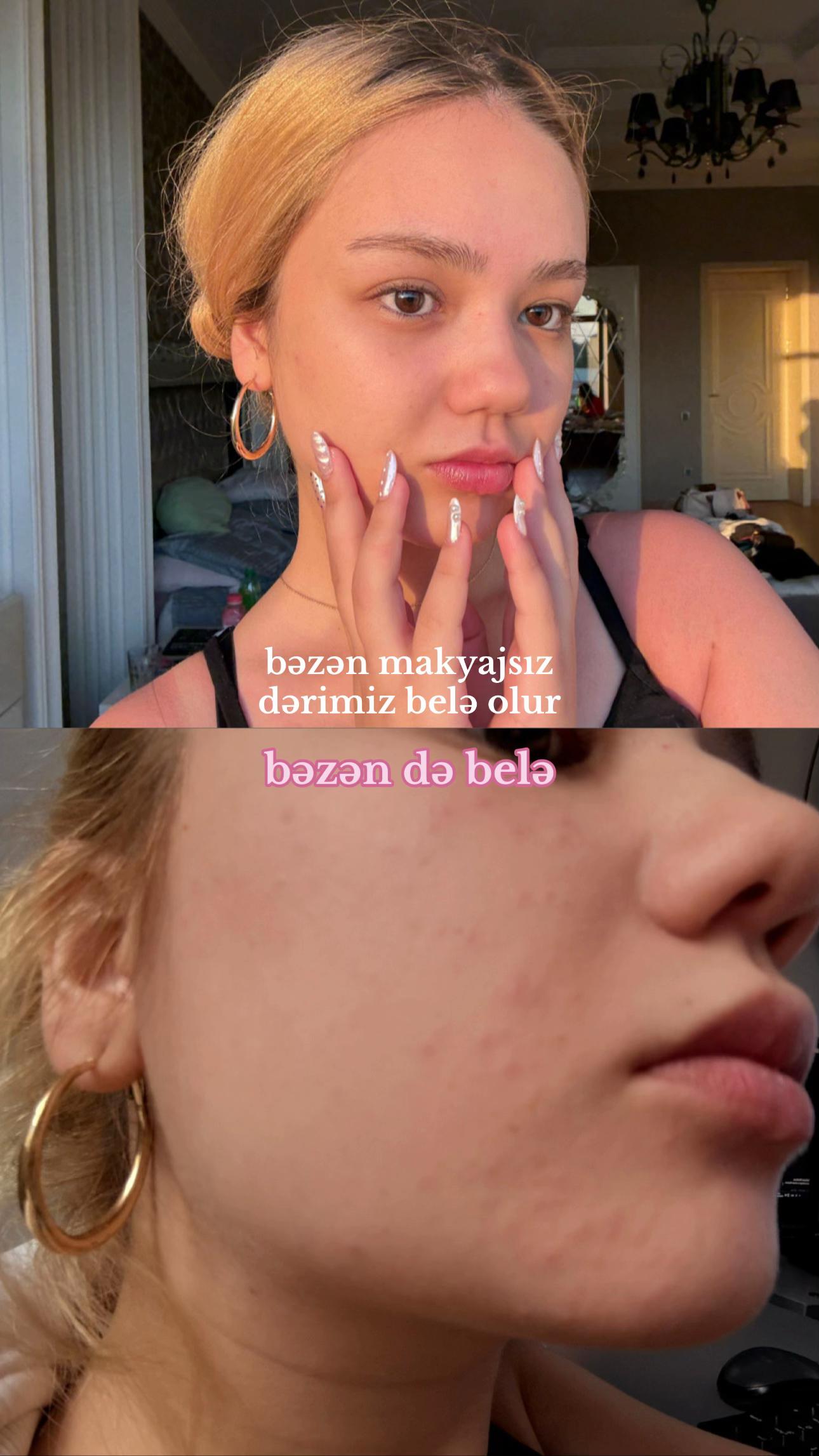 @nuraay
