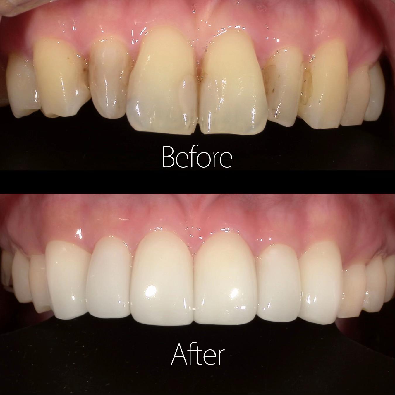 @DENTAL ALIEN