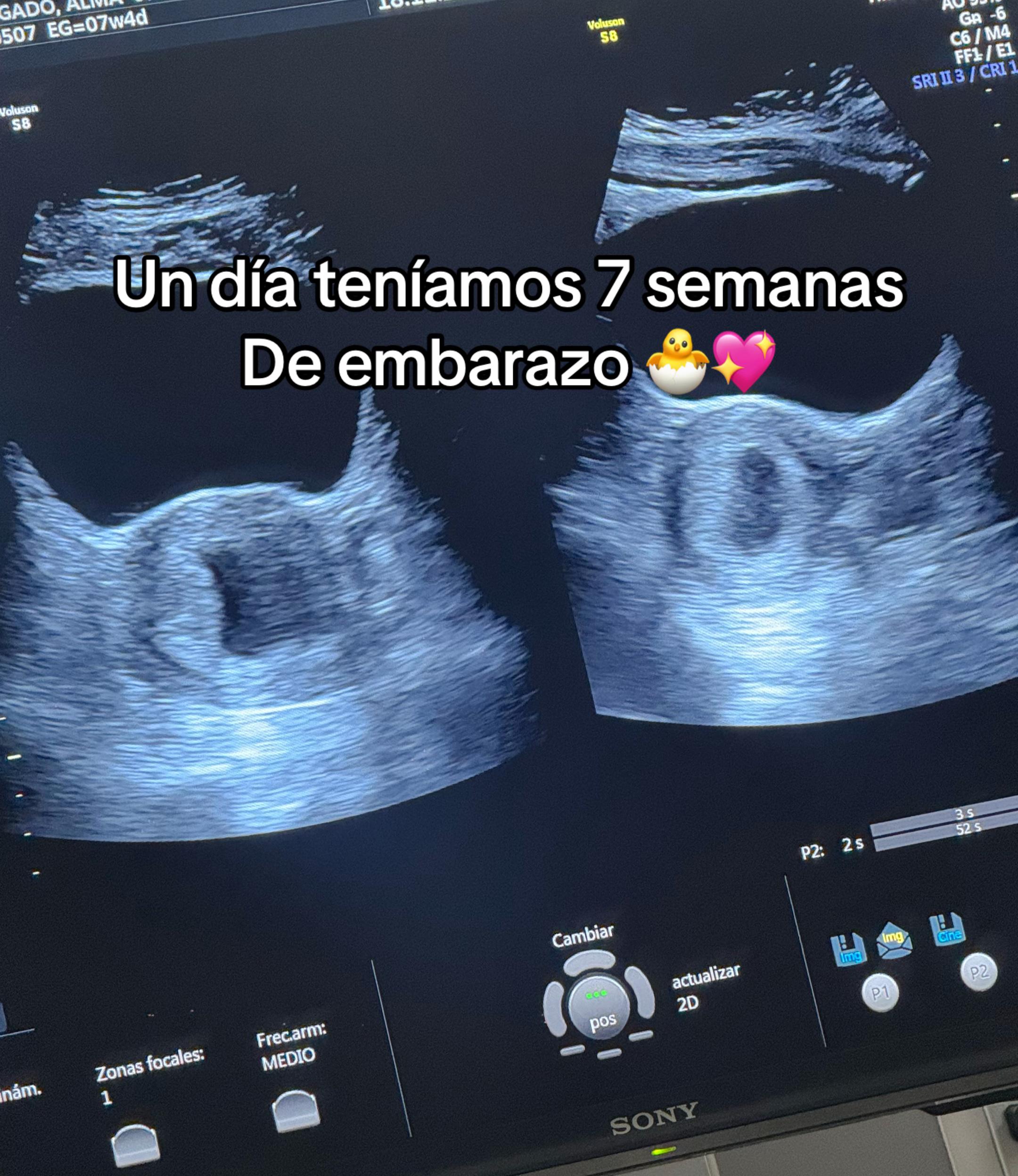 @❥ Almit&alpha;