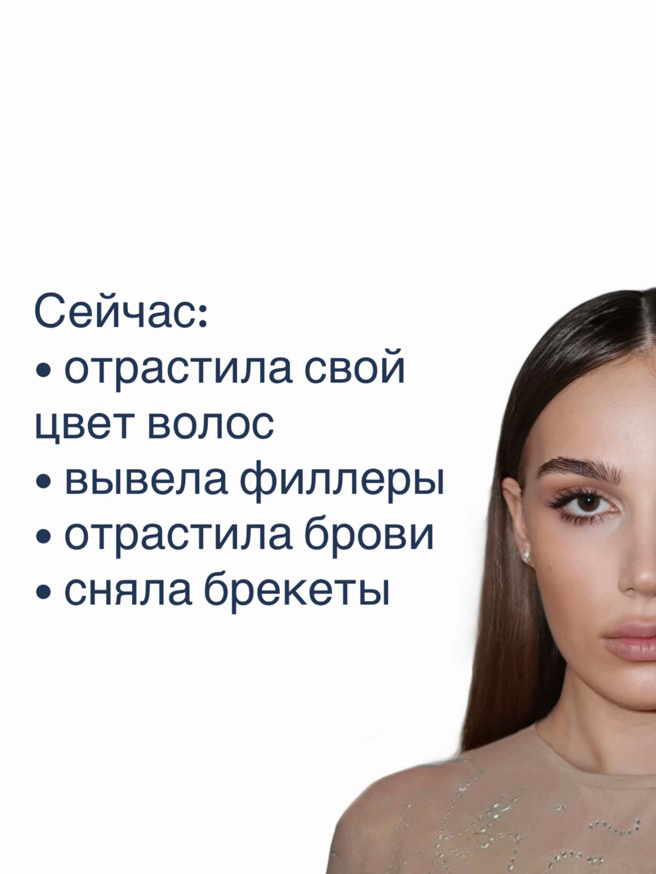 @Alina
