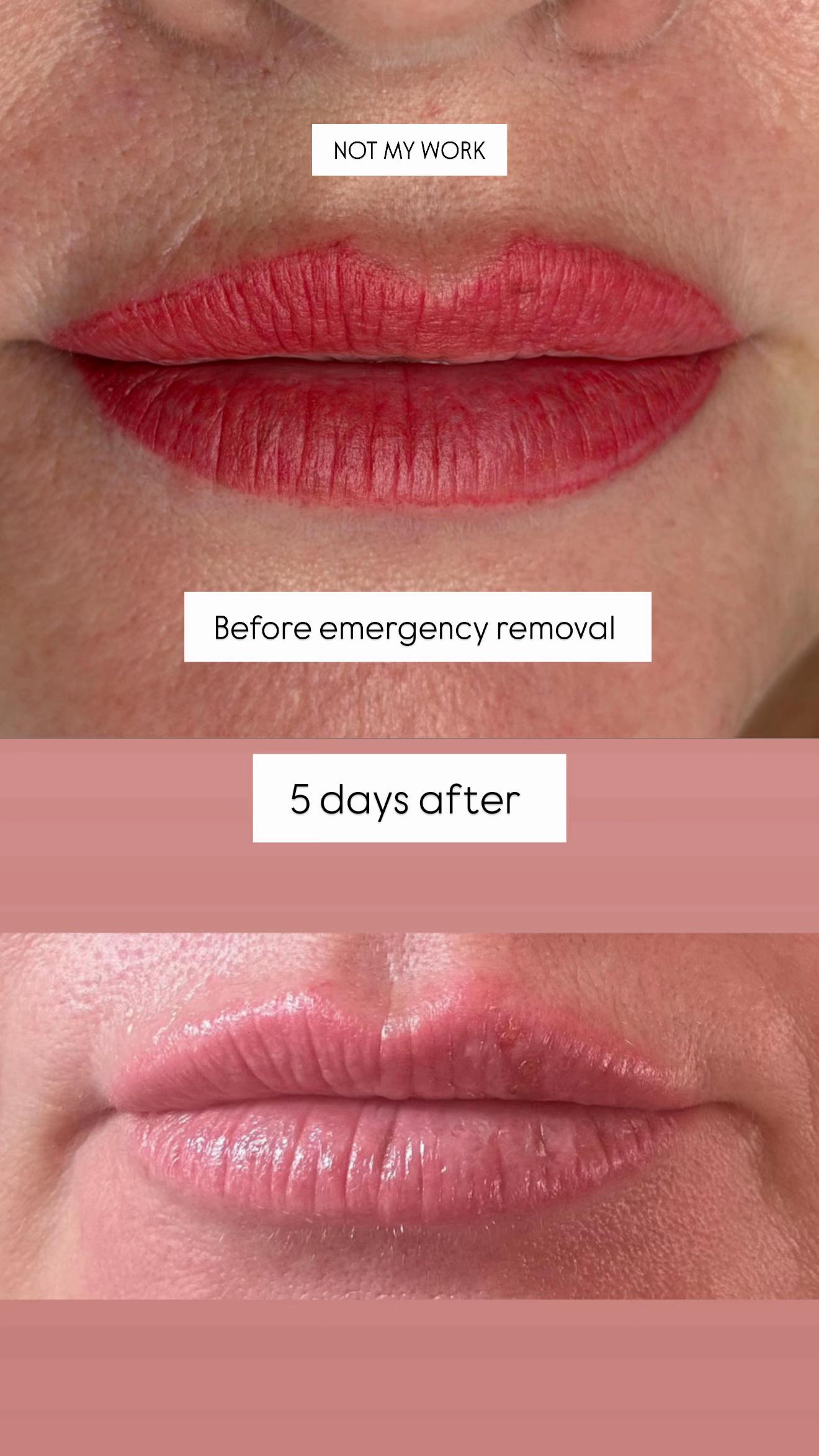 @Rebecca Teasdale | Lip Blush