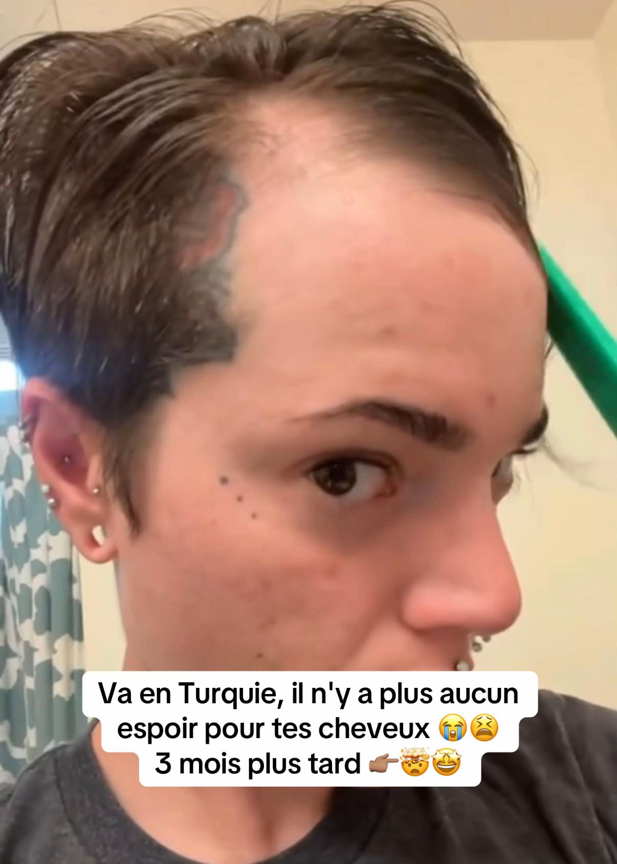 @Lux’Hair Growth