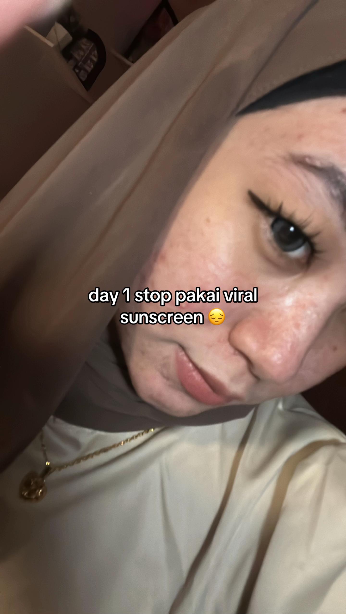 @M
