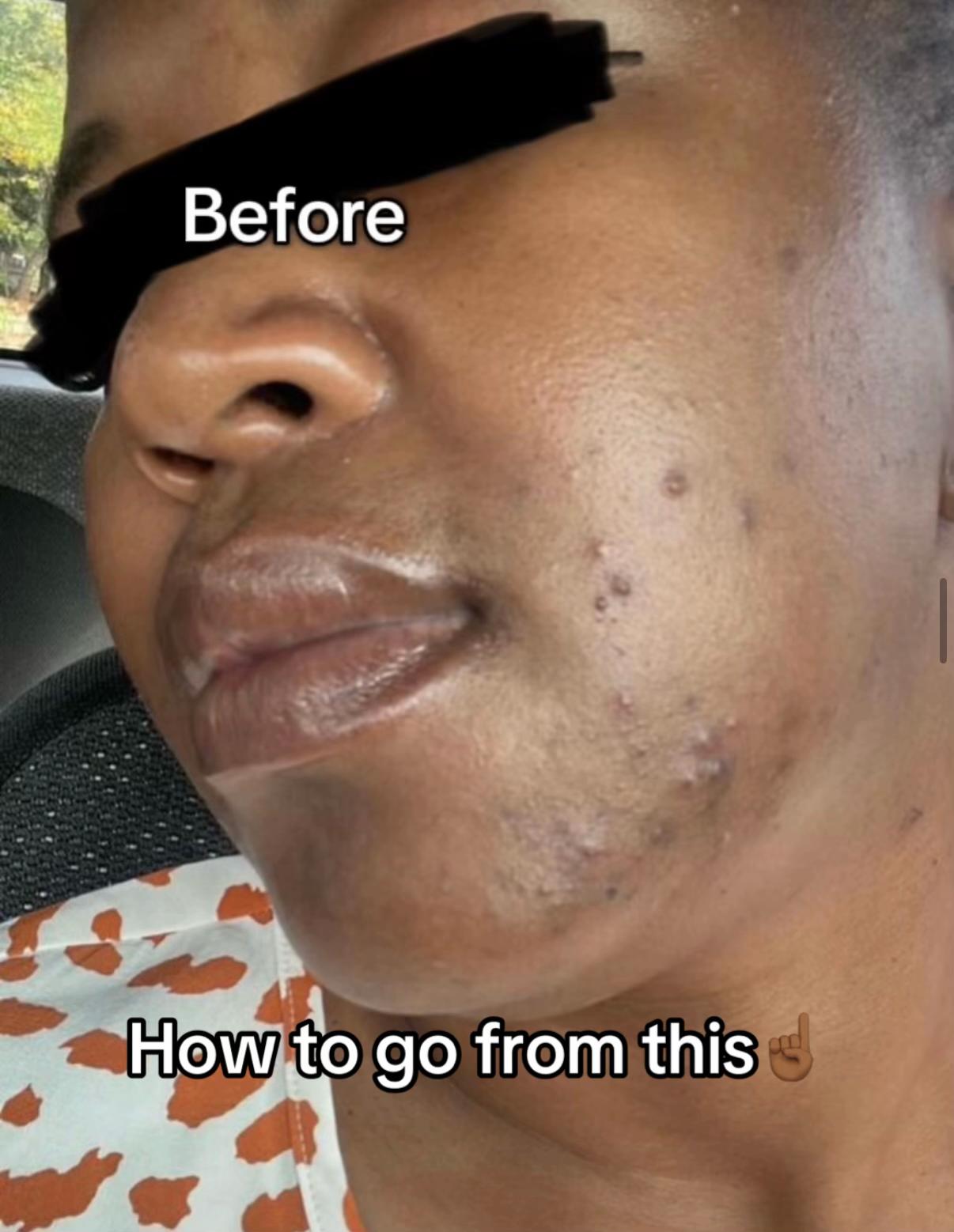 @the_skinlab_aesthetics