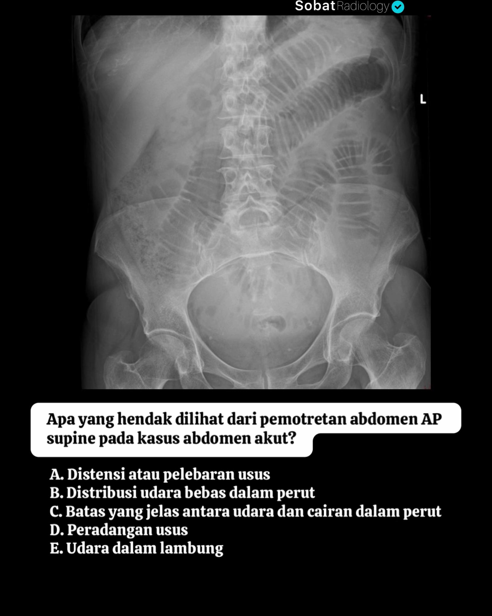 @Sobat Radiology