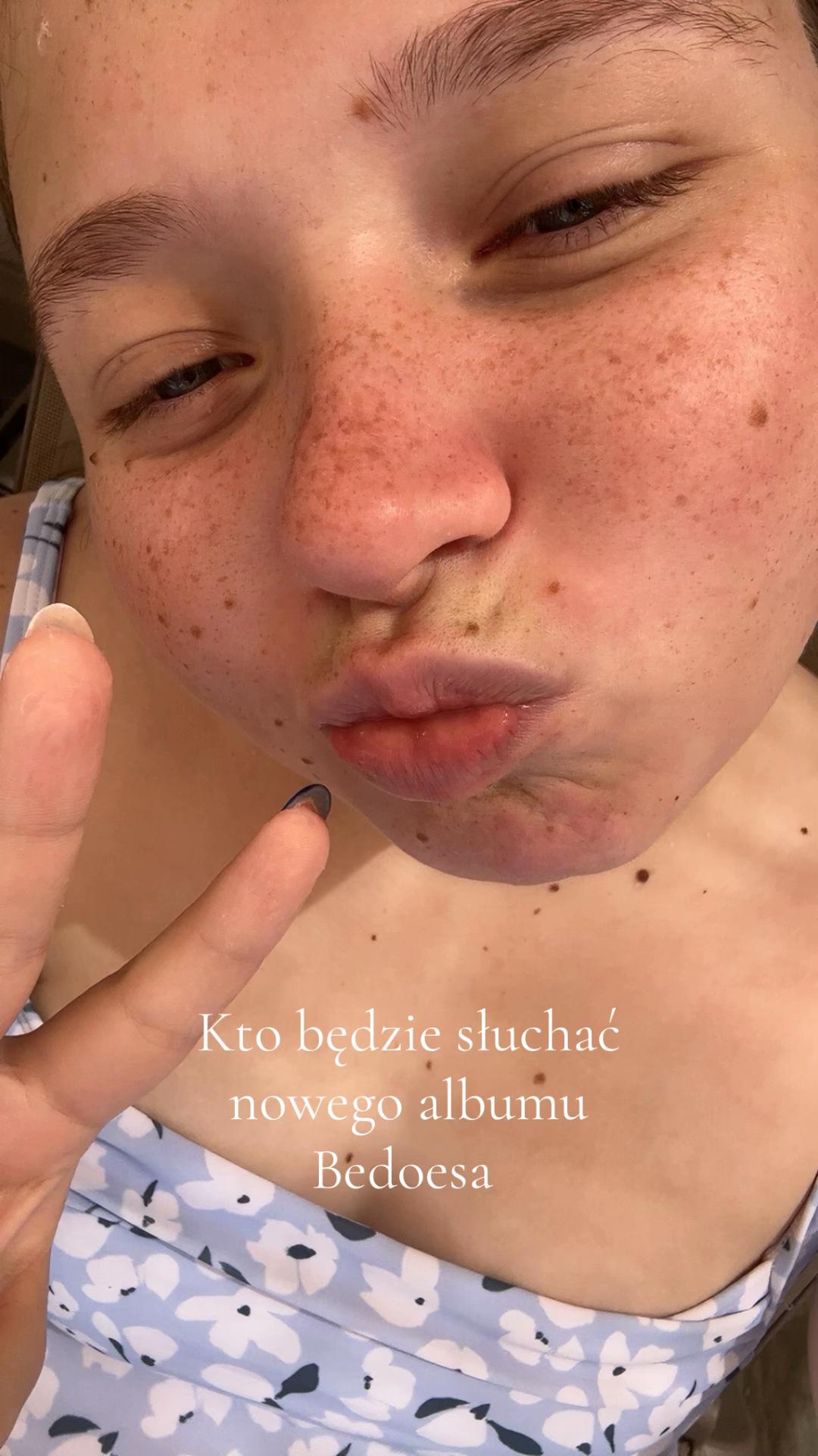 @Zuza 🤟🤍💙