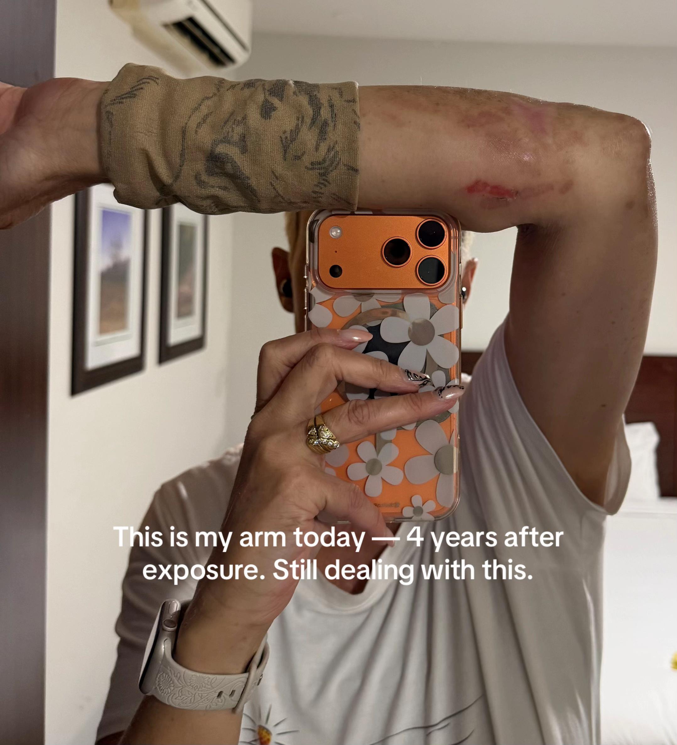@HermesVsGympieGympie