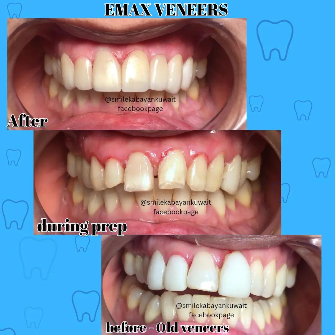 @SmileKabayanKuwait🇰🇼