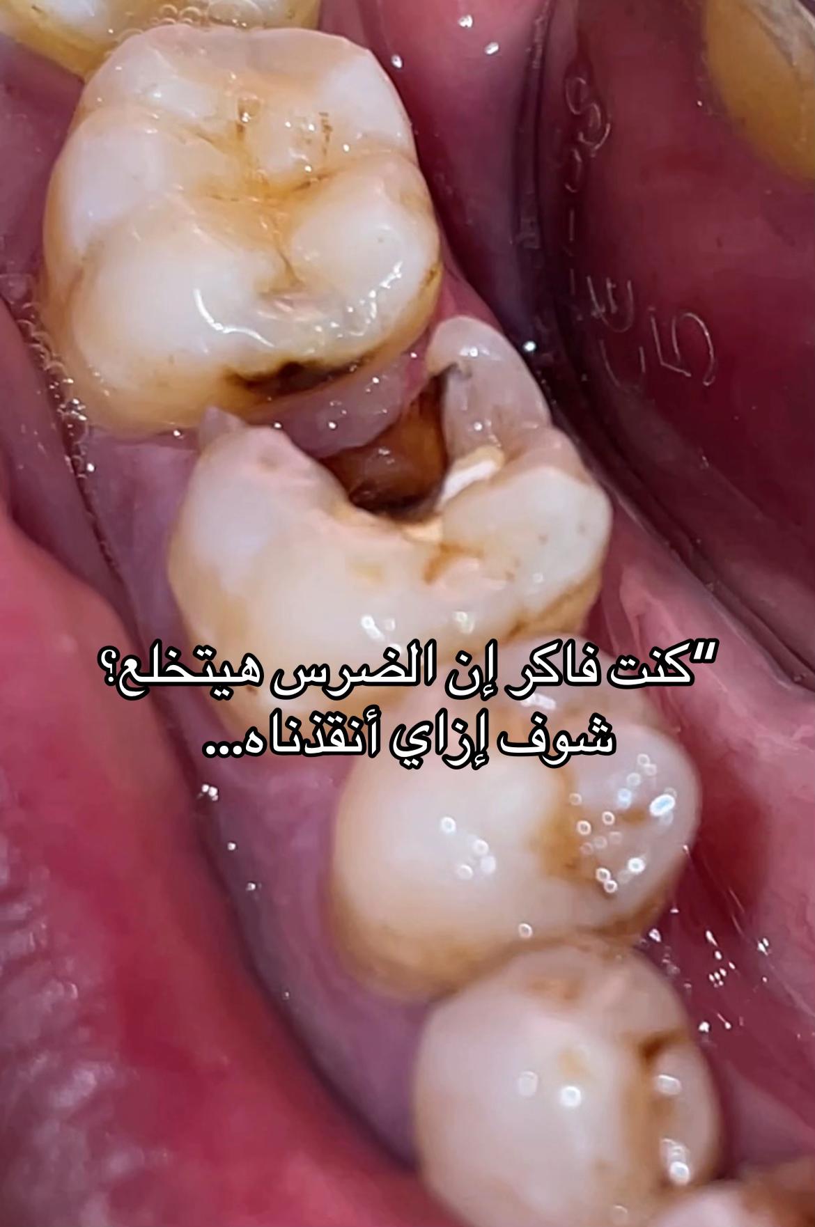 @Dr Mostafa Eita