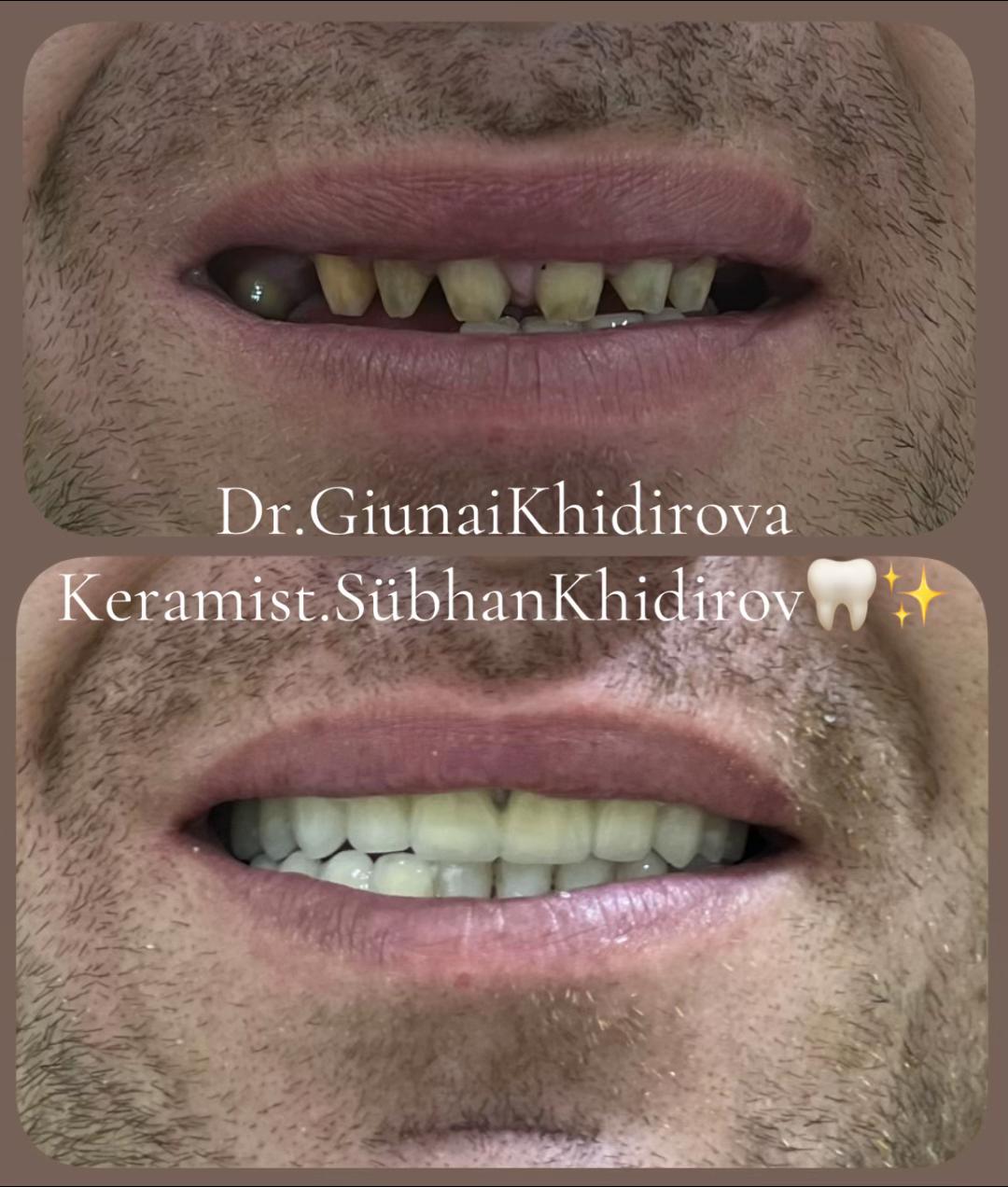 @Dr.Гюнай