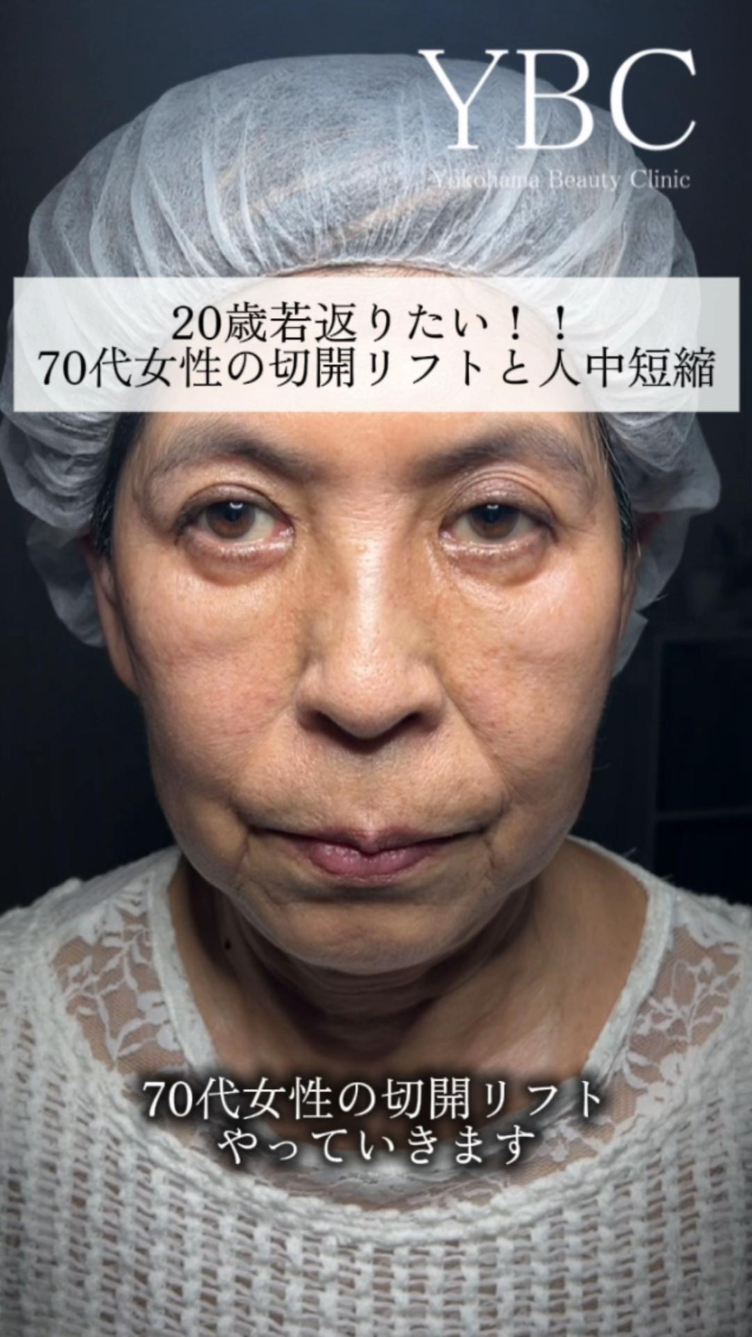 @イソセン/美容外科医（磯村亮輔院長）