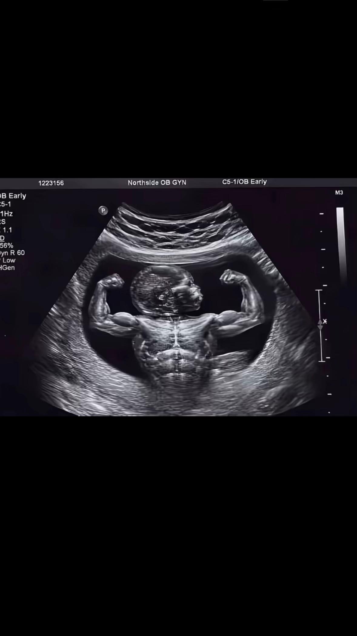 @๐๐ ๐บ๐ฉธ