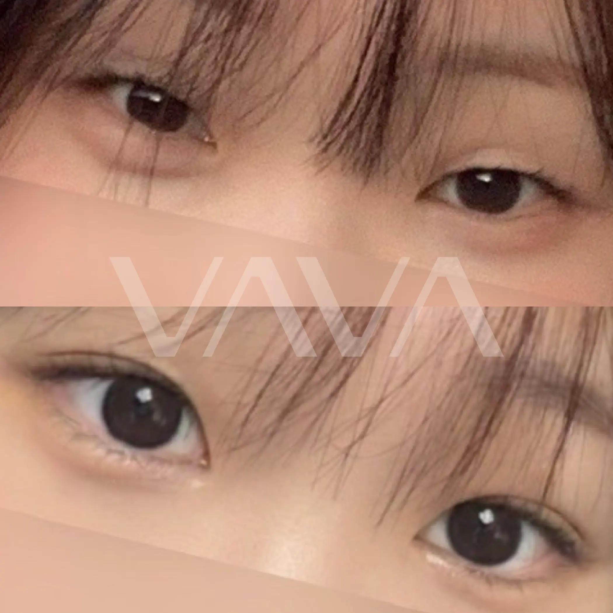 @VAVA美容整形外科