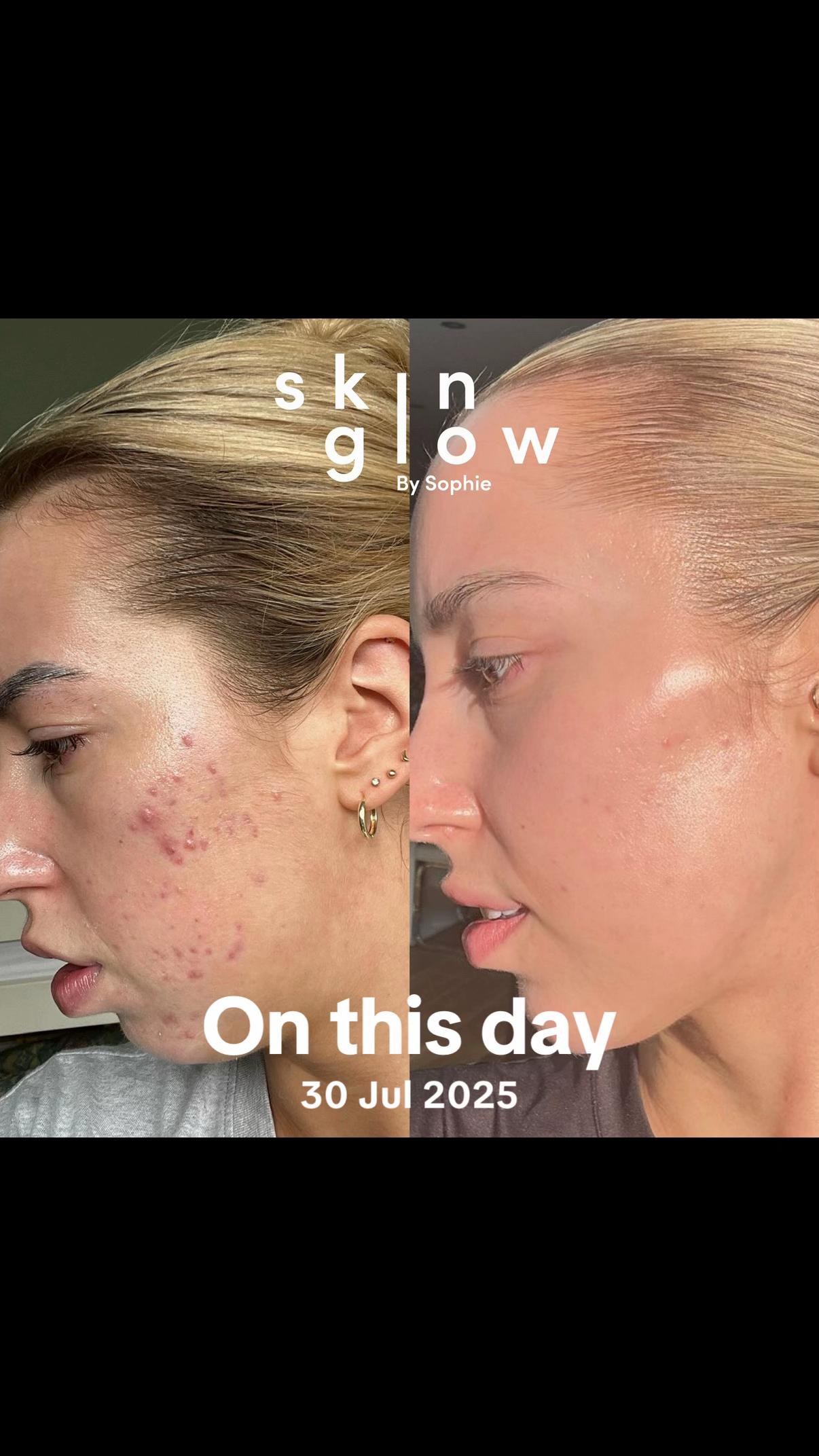 @Skinglowbysophie