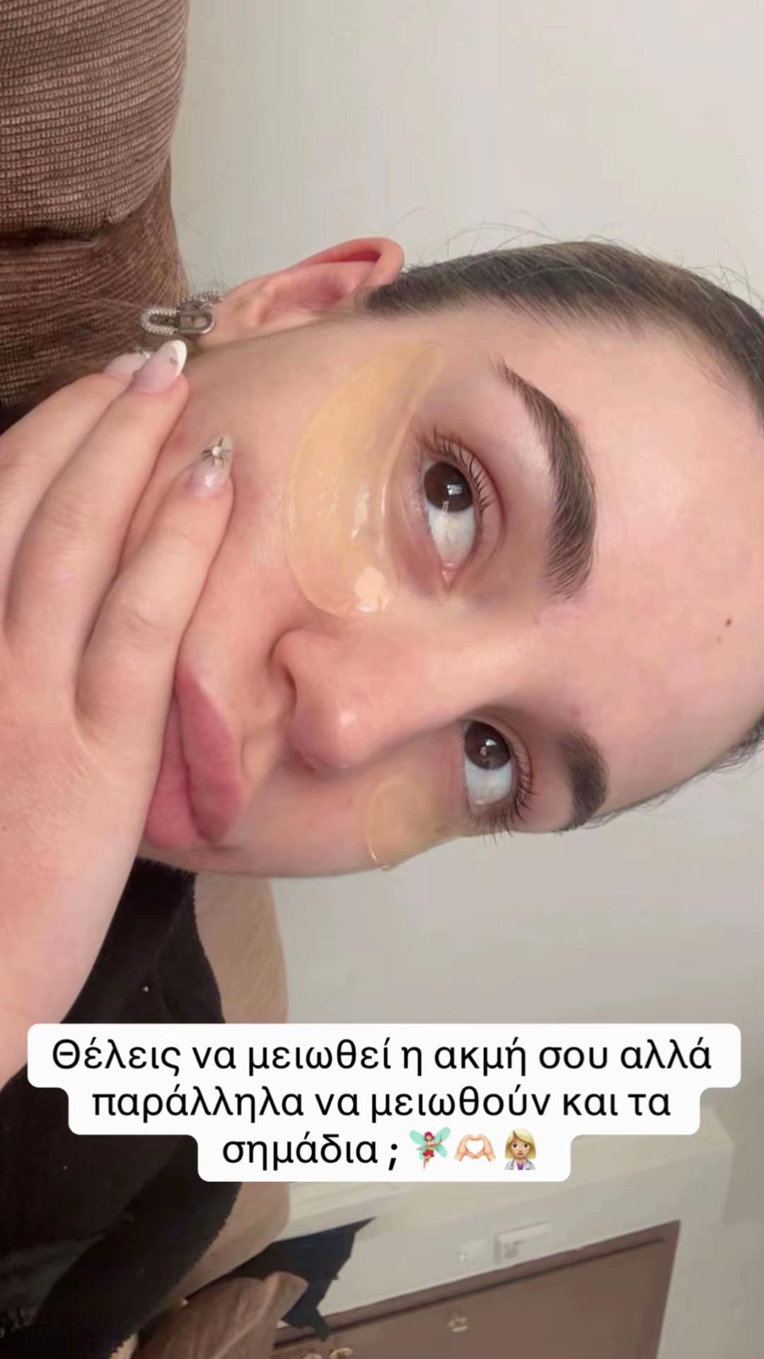 @Erika Kapsalaki