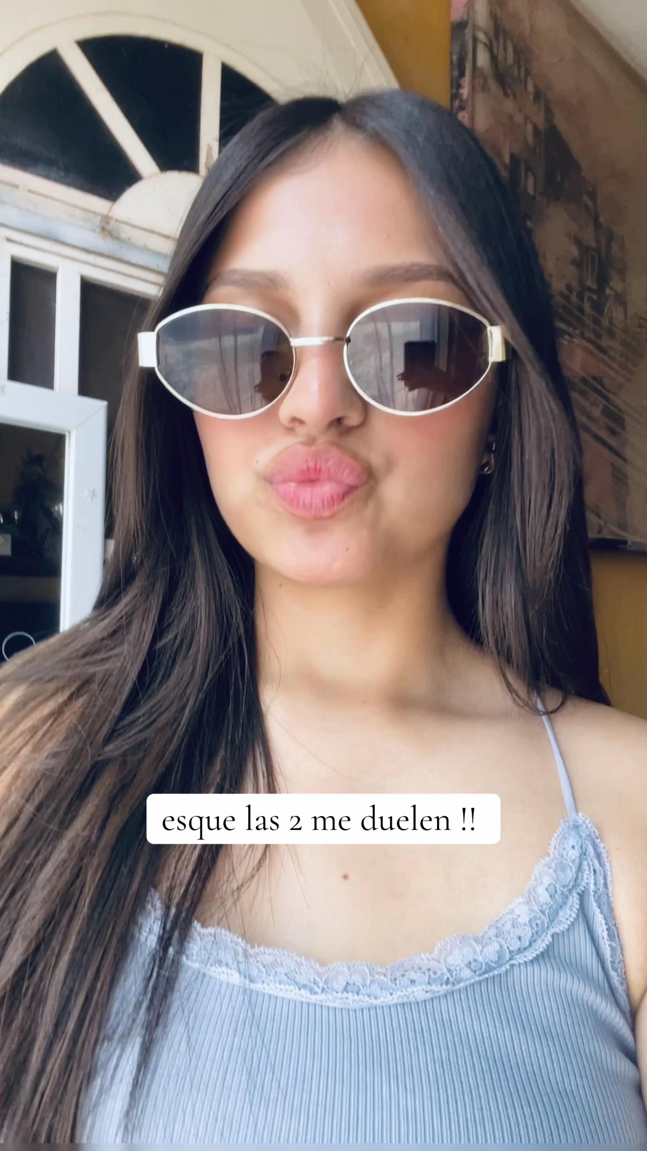@ALE