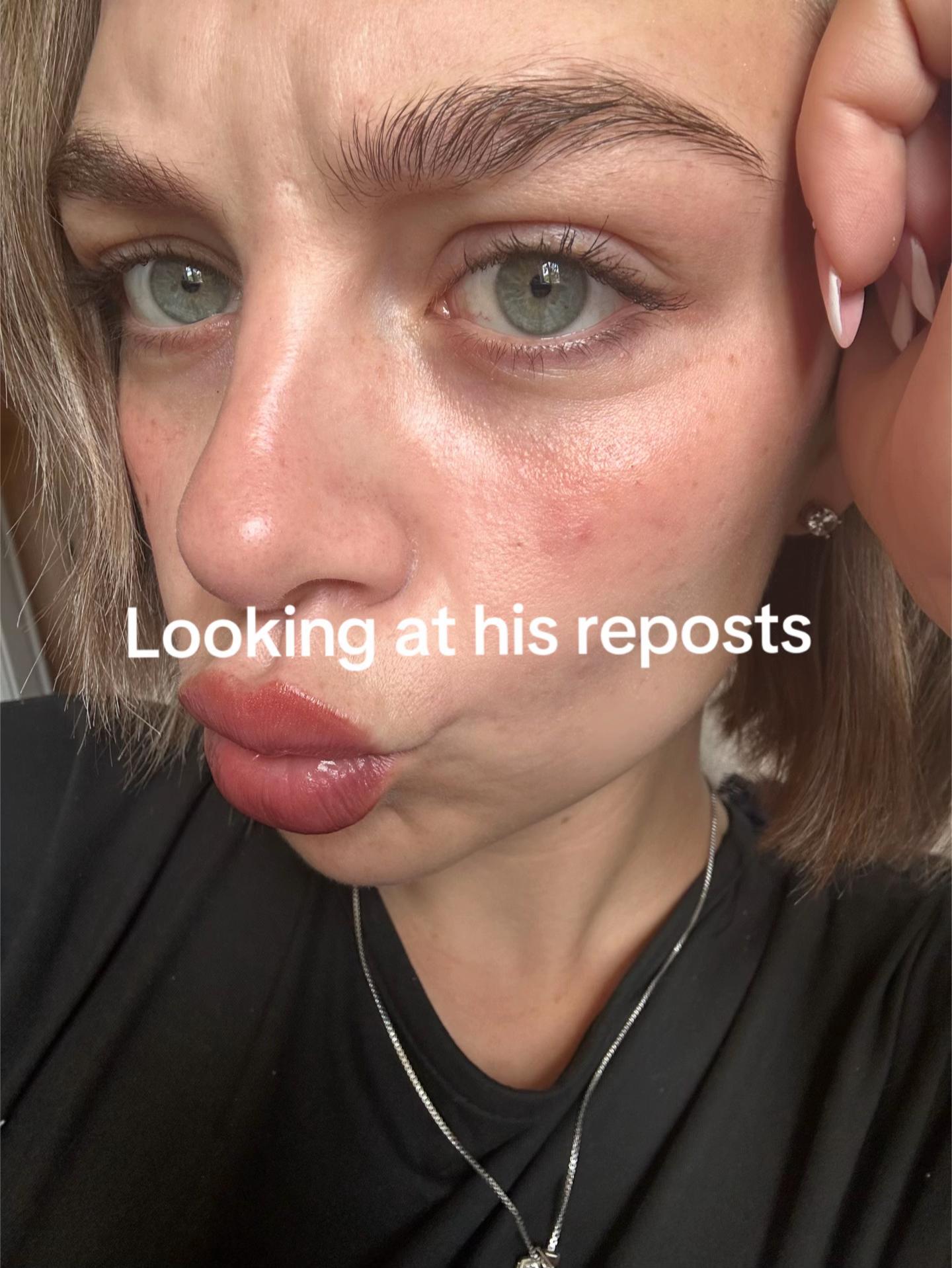 @M🍒