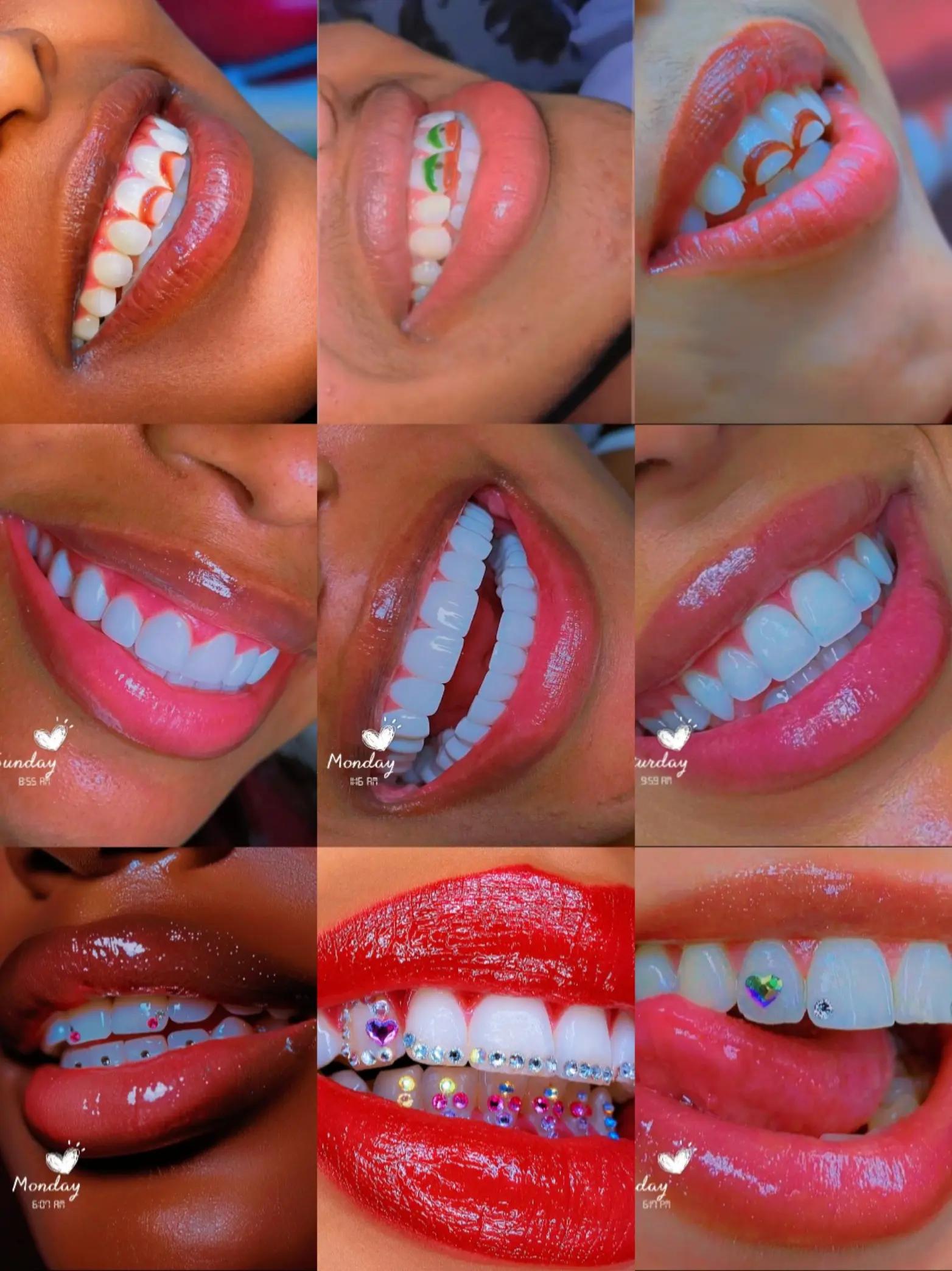 @Dr.Naasir🦷🩵🩺