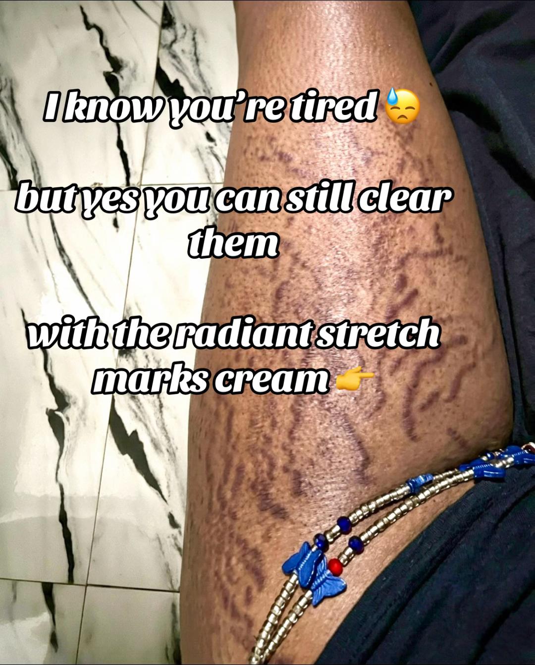 @Radiant skin