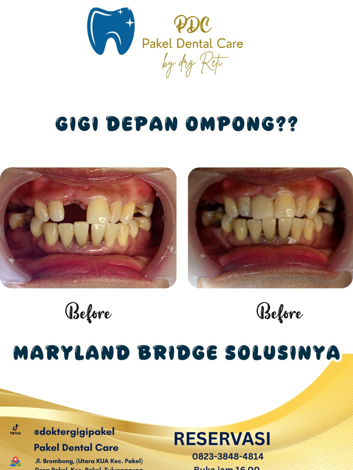 @Pakeldentalcare