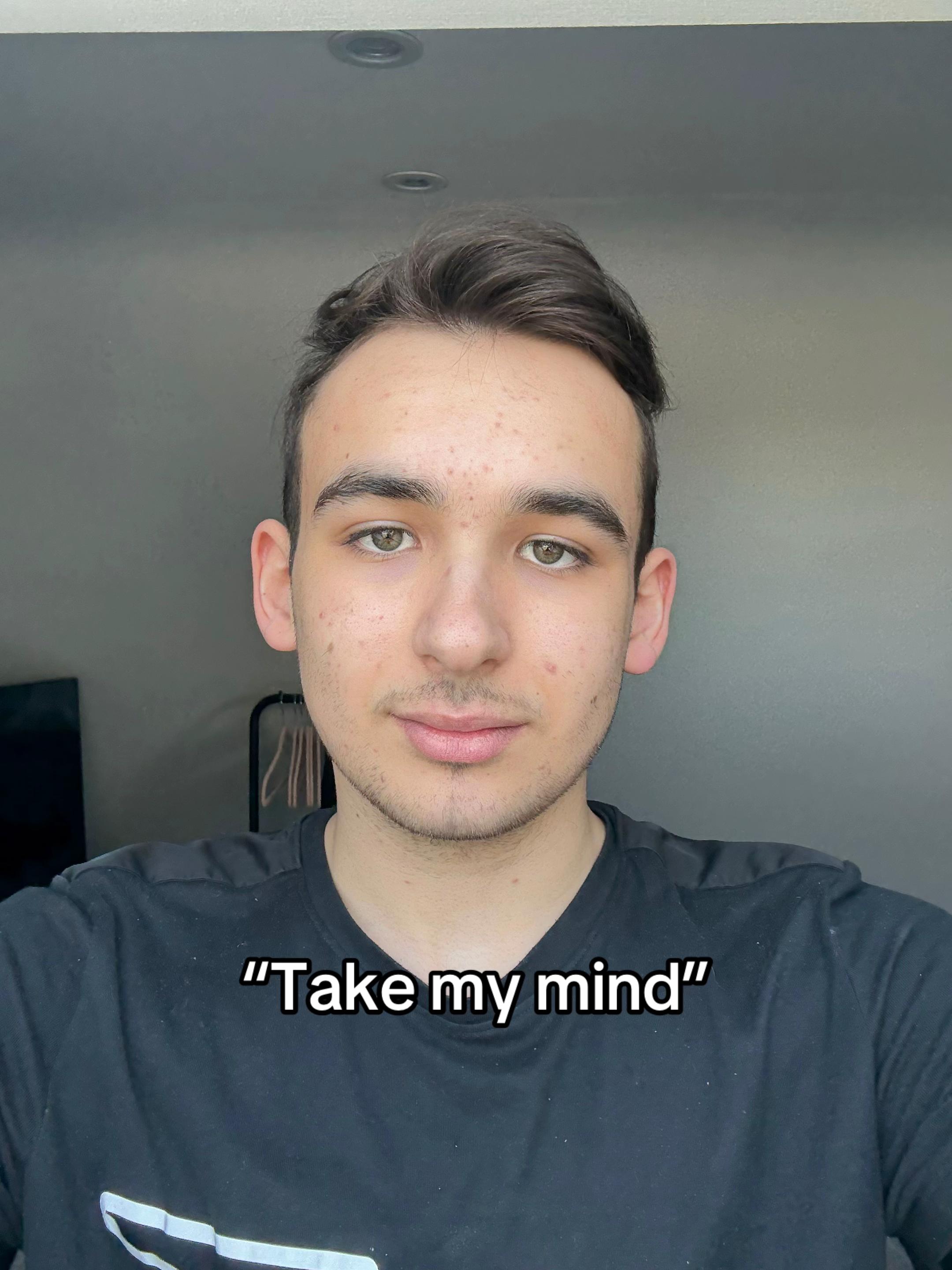 @Sam | CasesByTeen