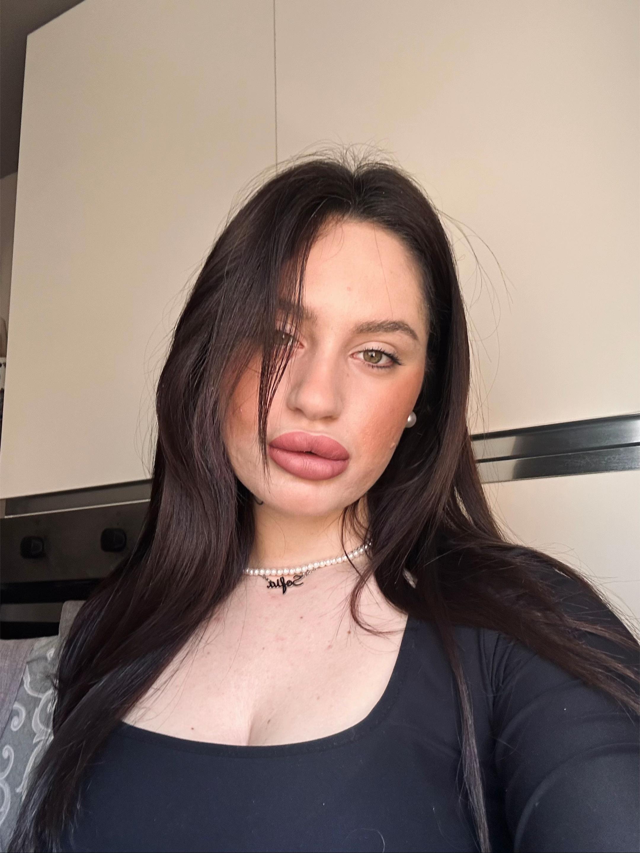 @Aurora Badini