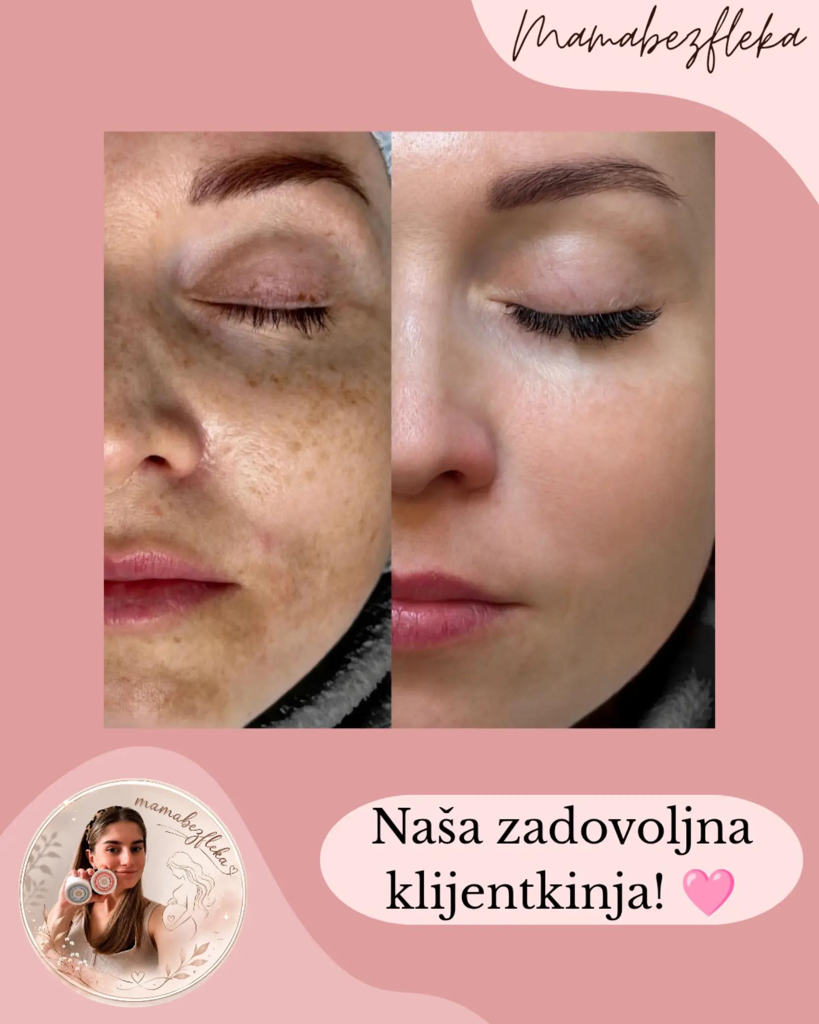 @Mama bez fleka