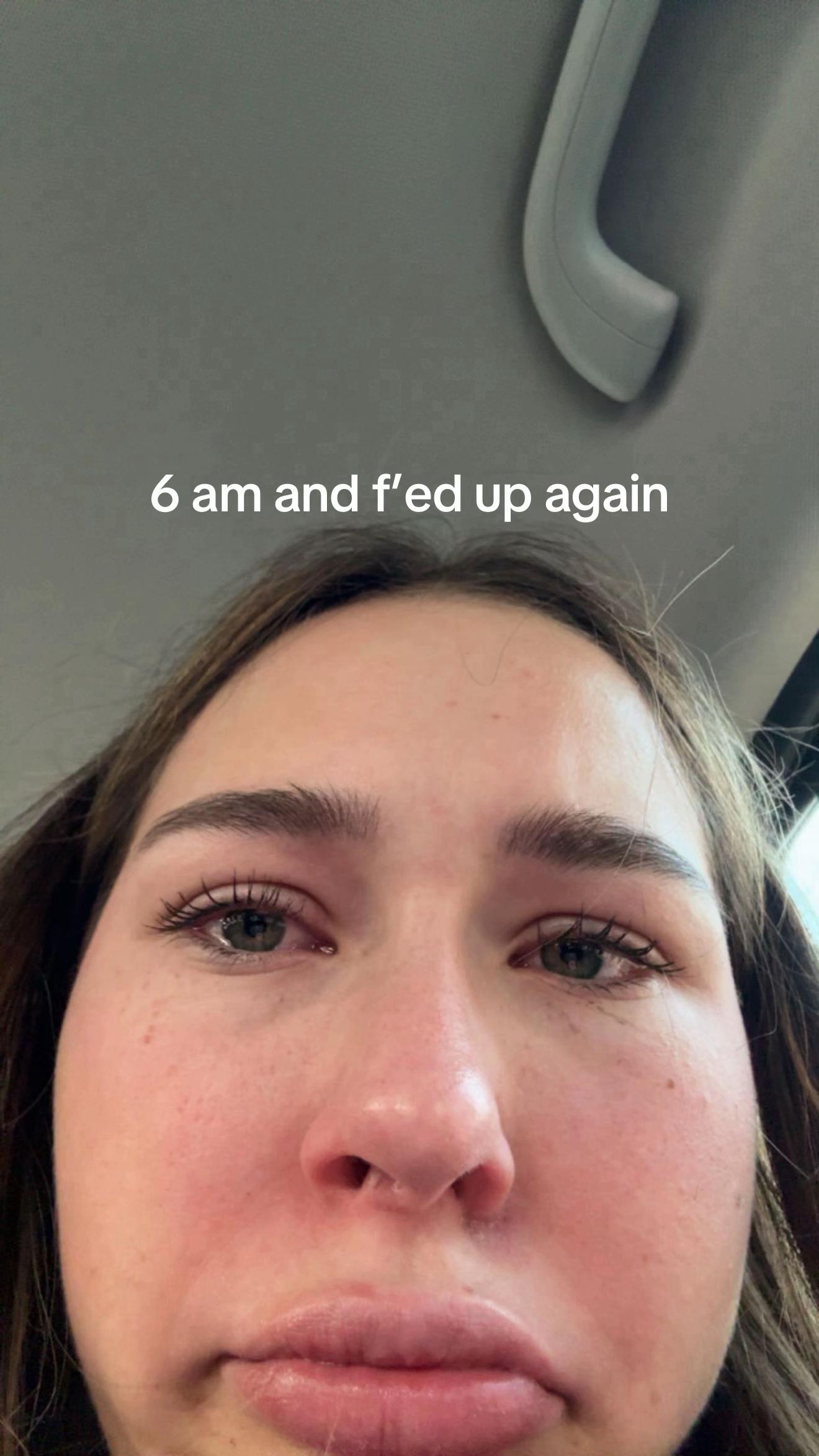 @Ellie