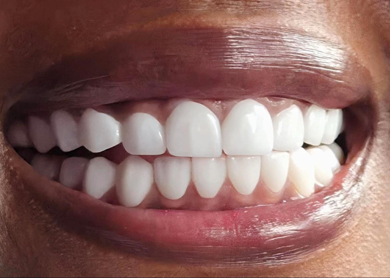 @SMILES