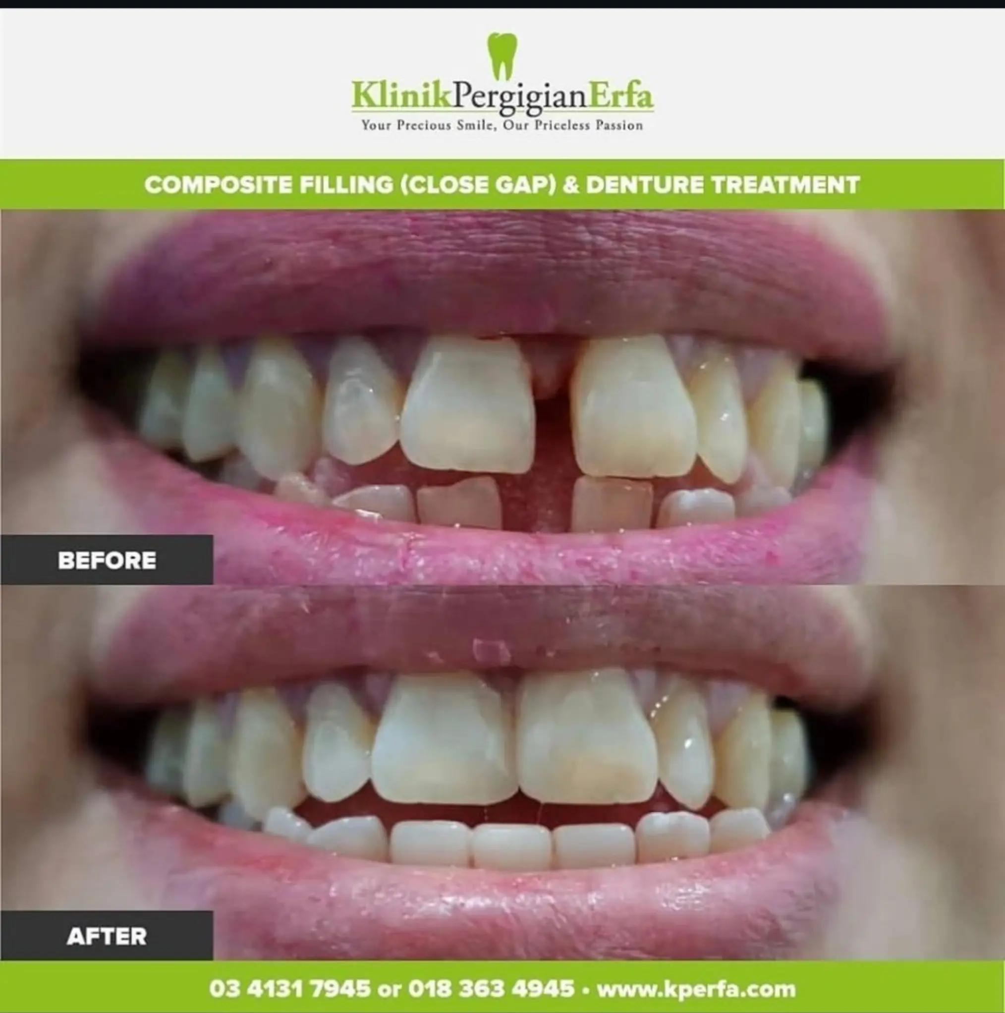 @Klinik Pergigian Erfa